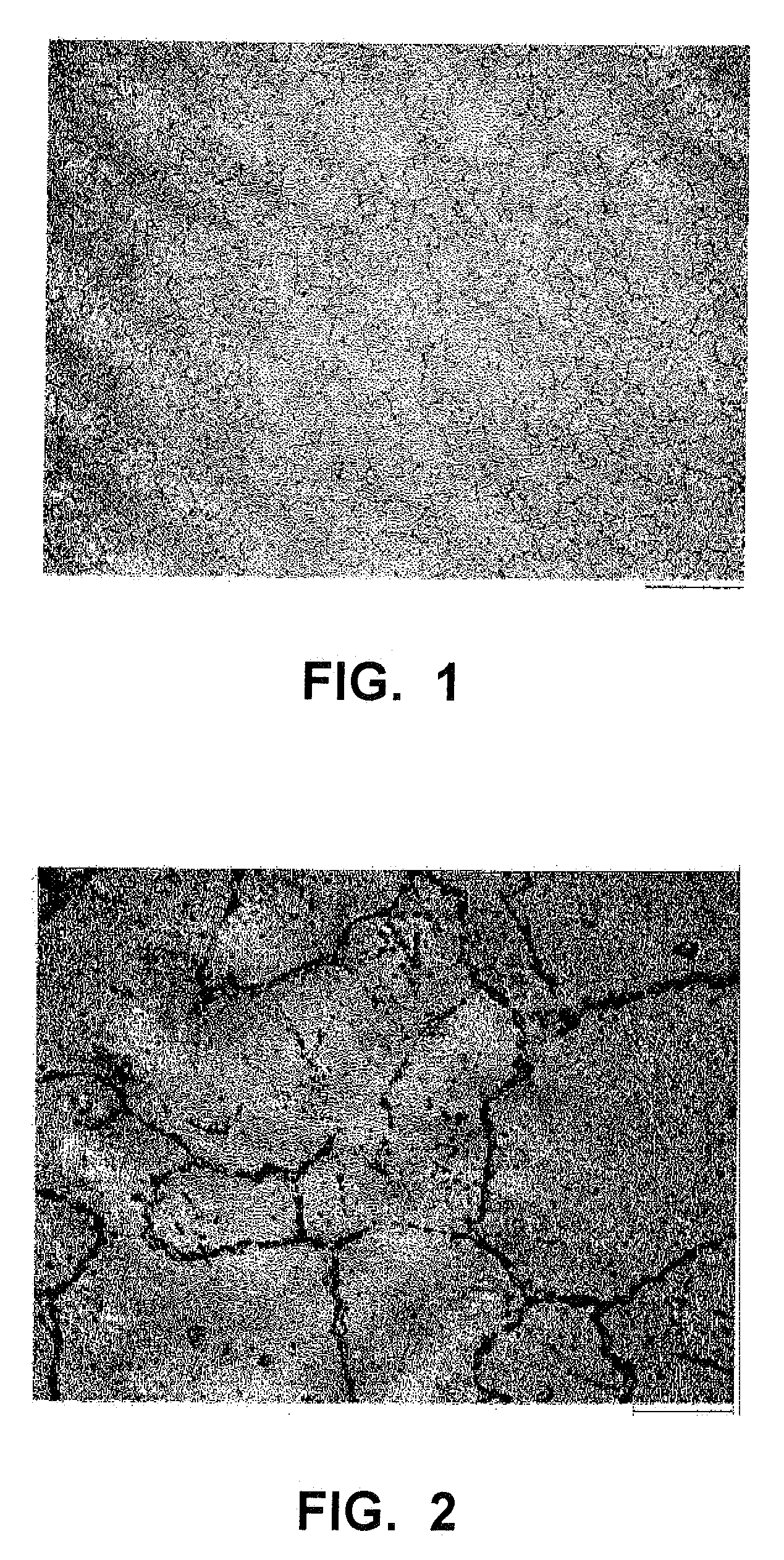 Precipitation-strengthened nickel-iron-chromium alloy and process therefor