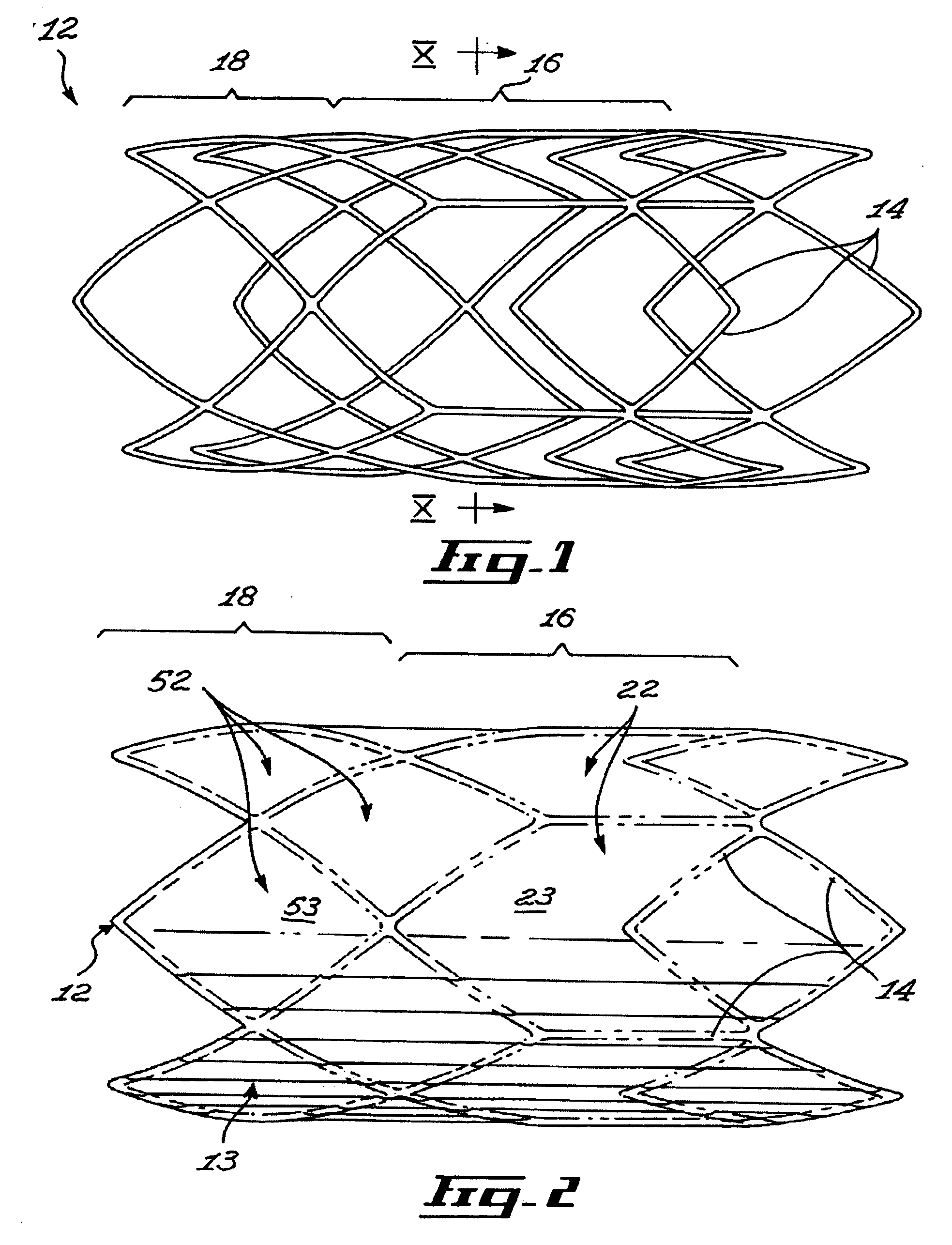 Stent and method of manufacturing same