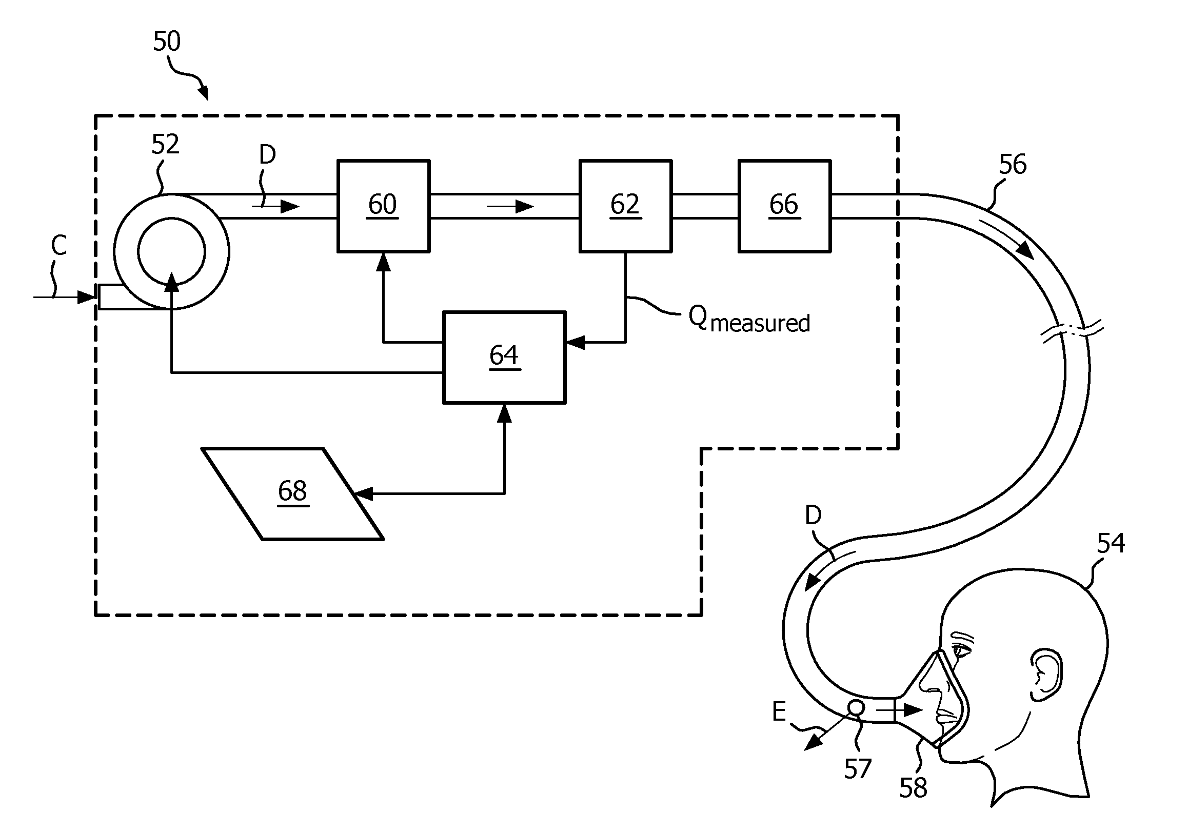 Upper airway resistance measurement device