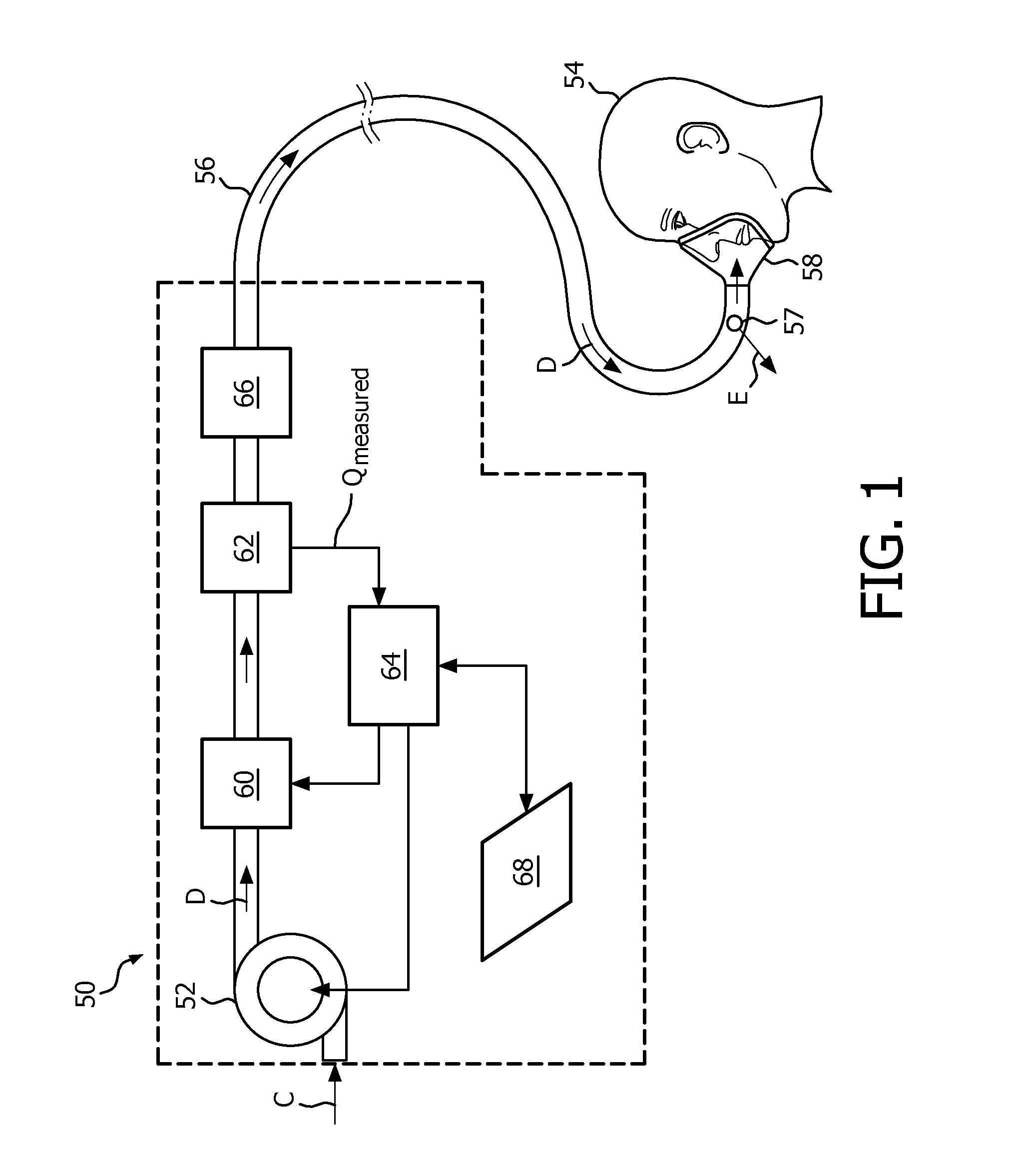 Upper airway resistance measurement device