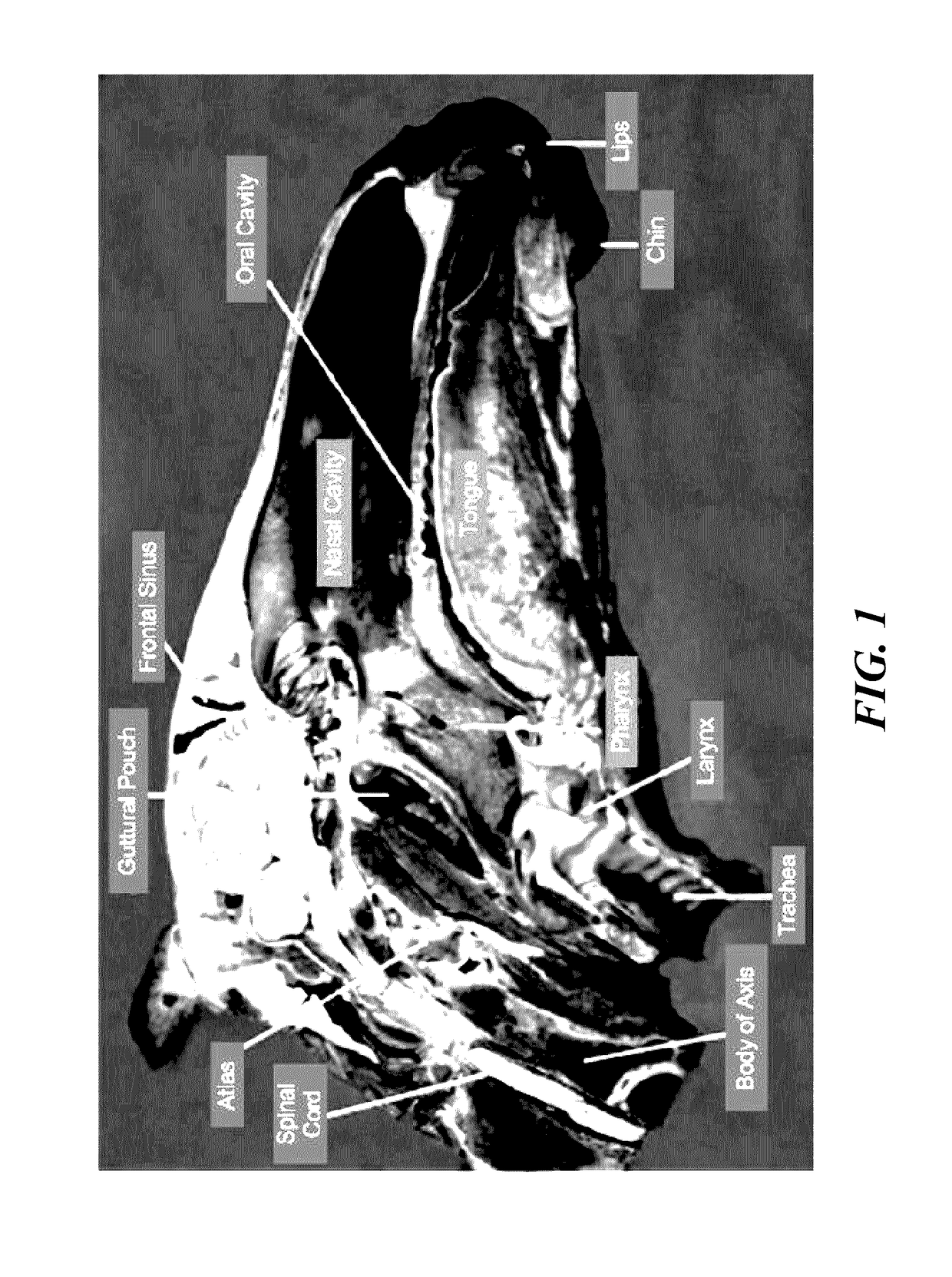 Adaptive airway treatment of dorsal displacement disorders in horses