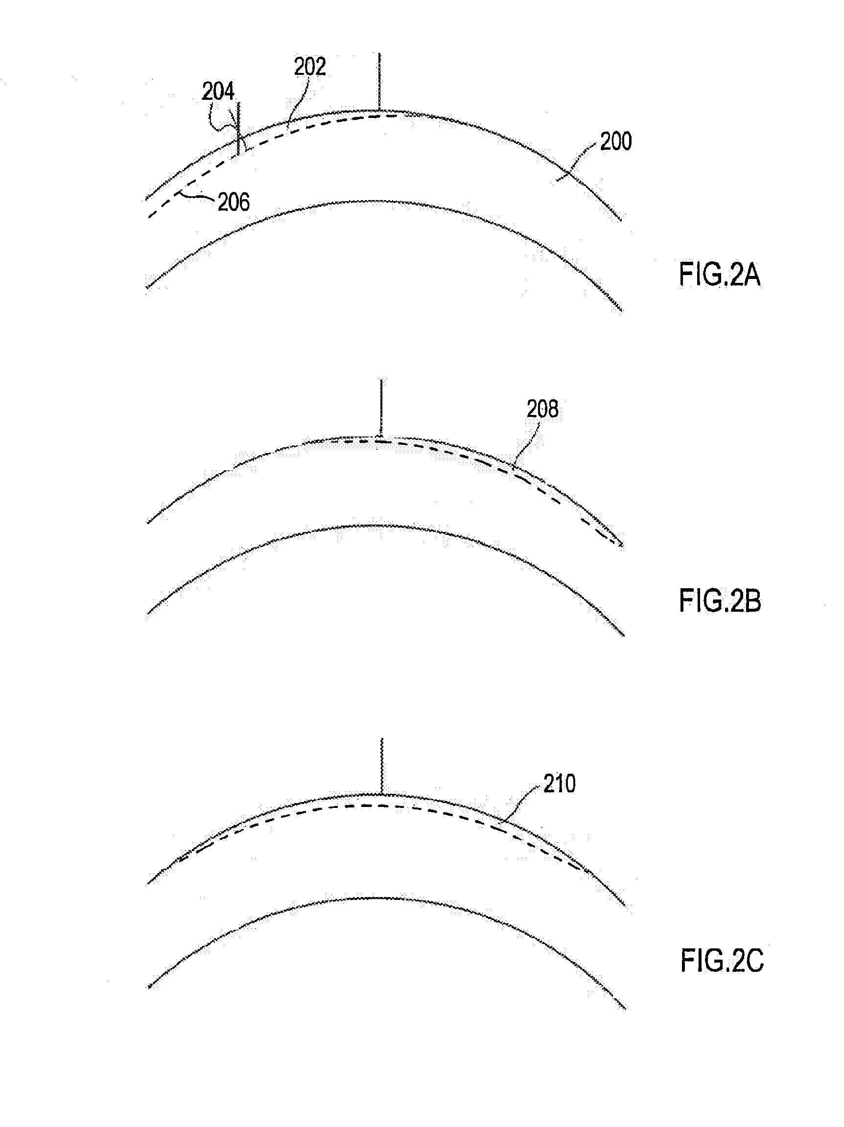 Method and Apparatus for Multi-Step Correction of Ophthalmic Refractive Errors