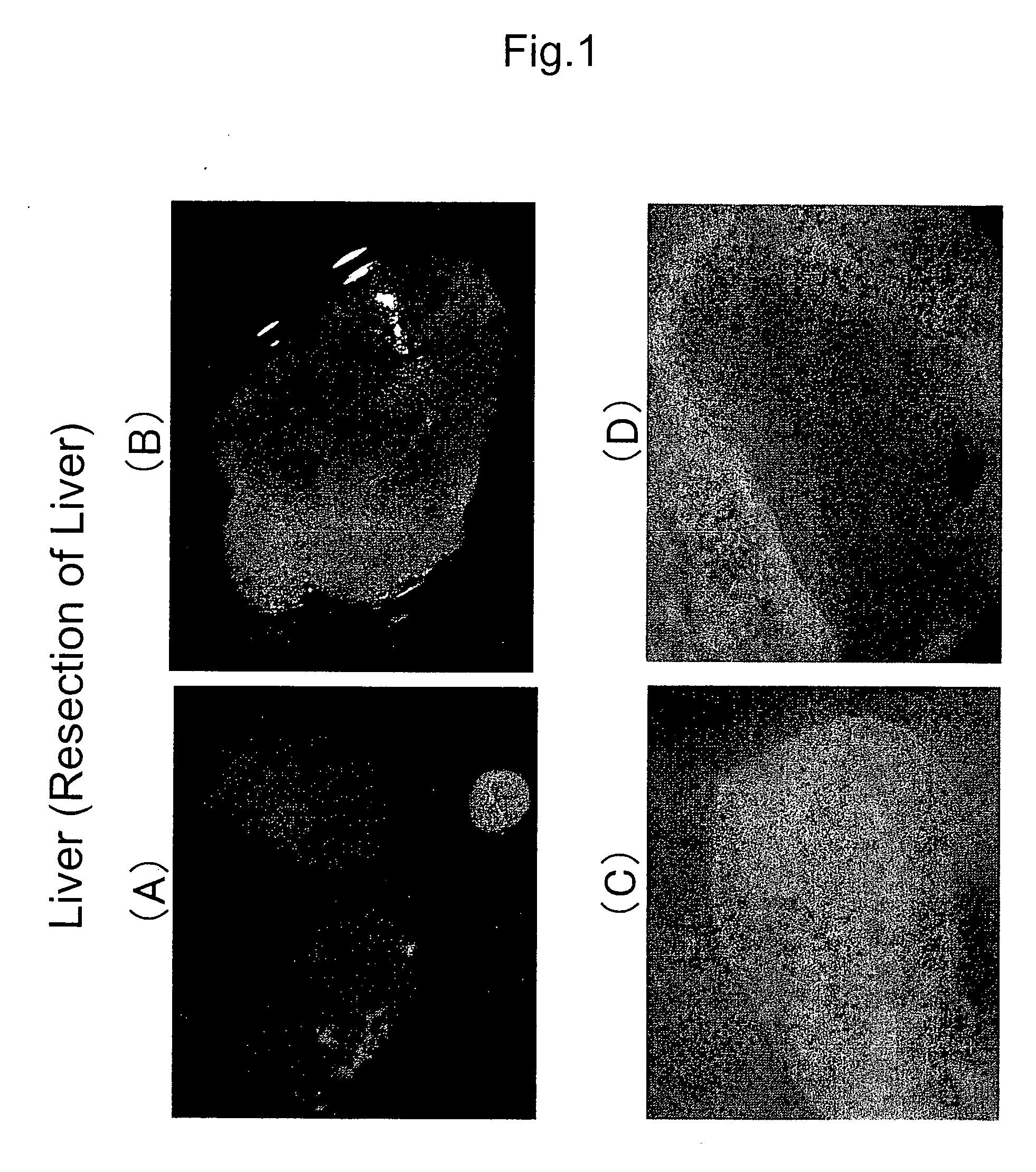 Method of organ regeneration