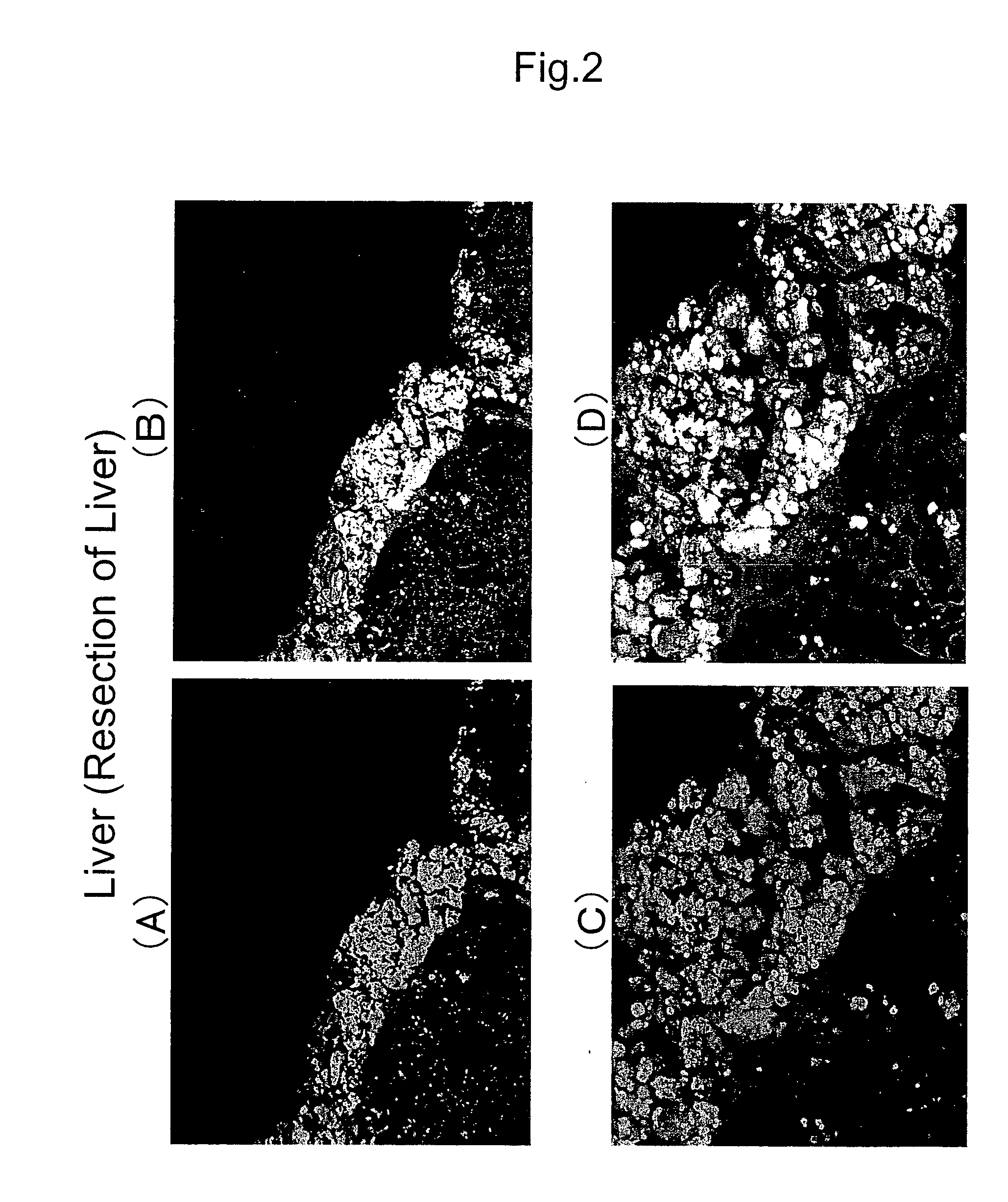 Method of organ regeneration