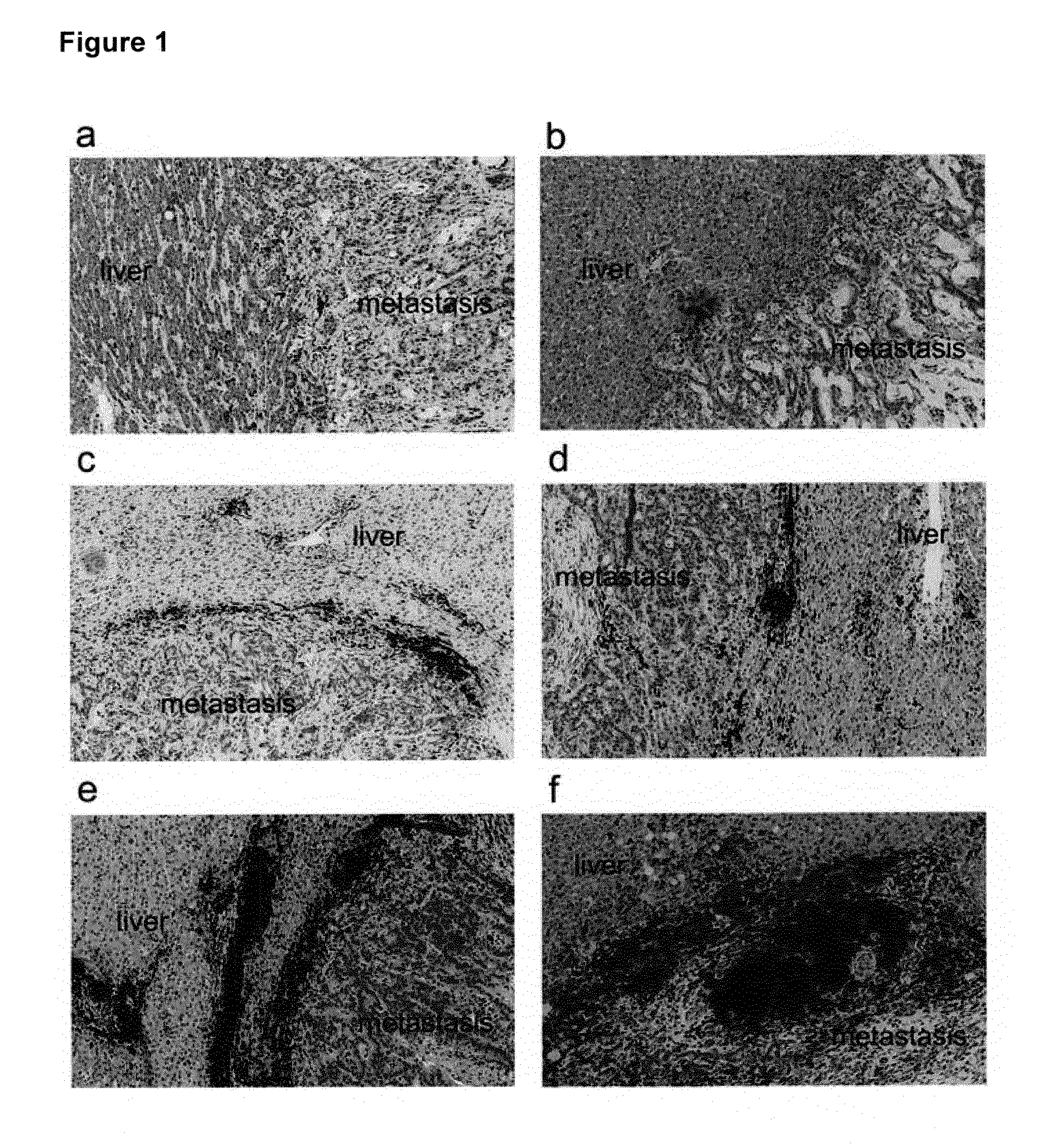 Means and methods for the prediction of treatment response of a cancer patient