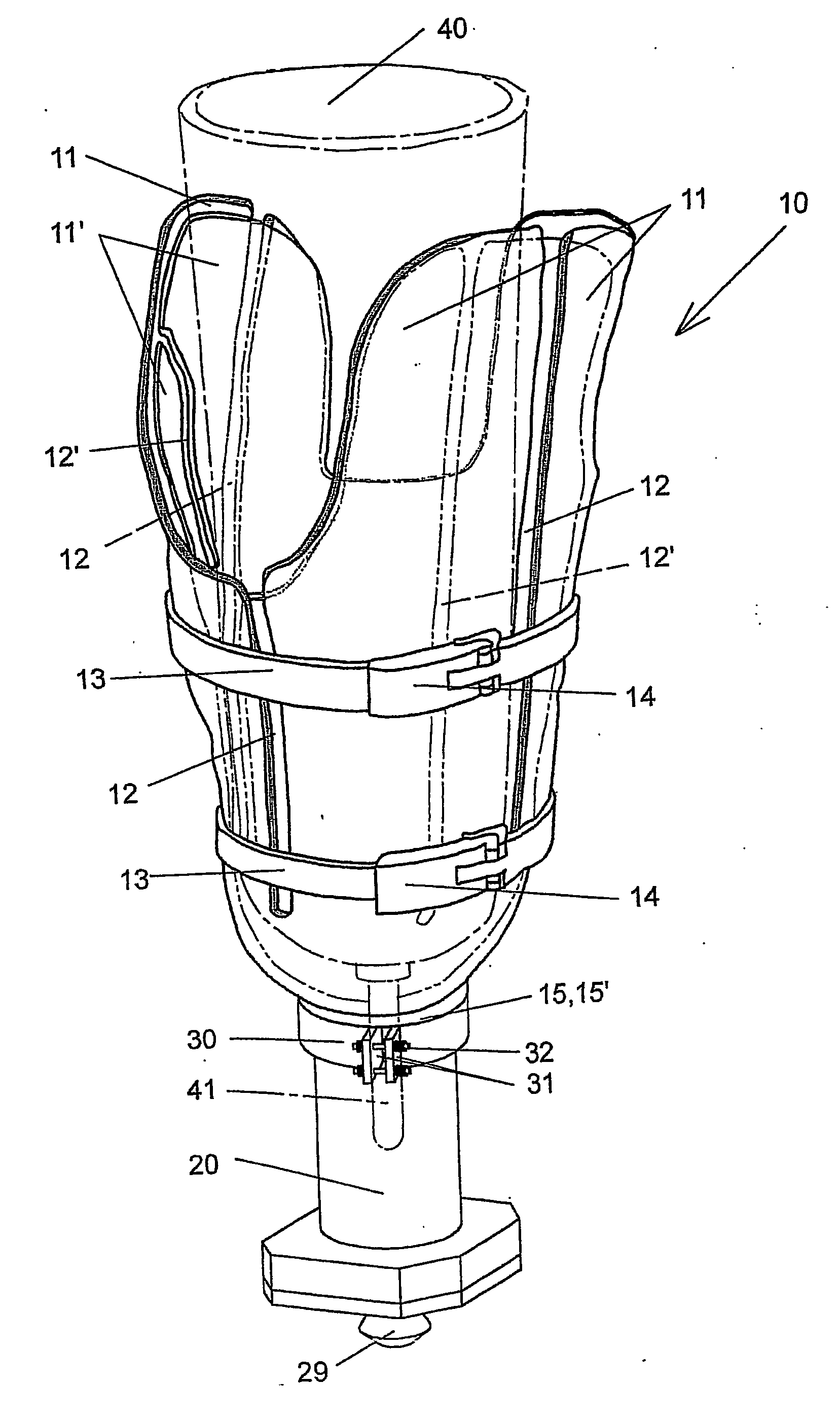 Prosthesis