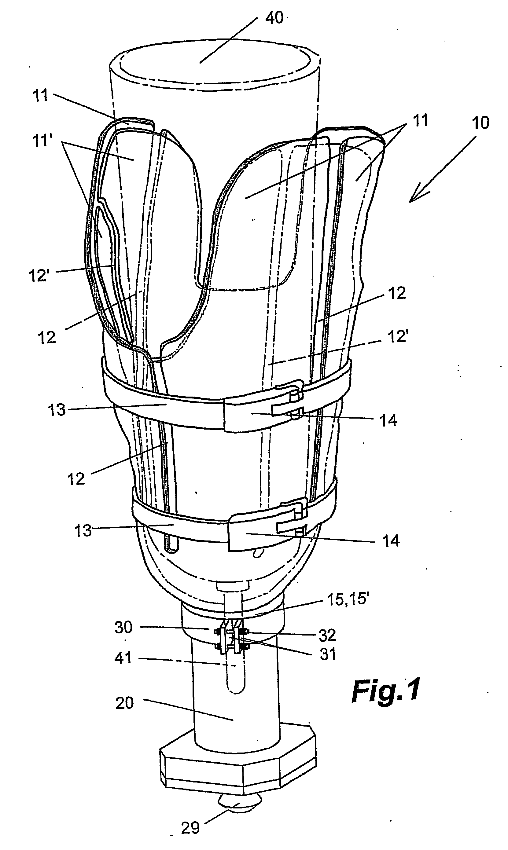 Prosthesis