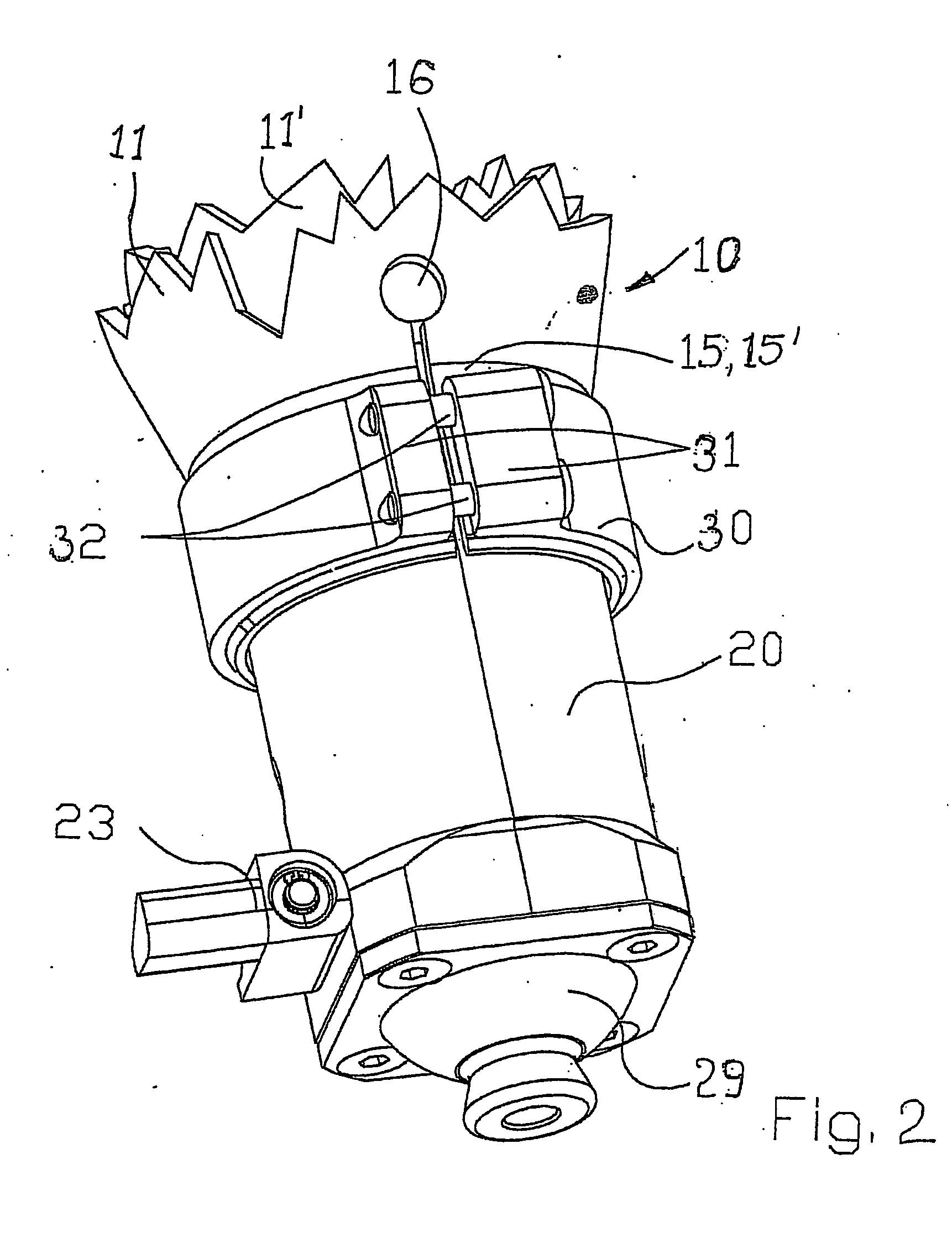 Prosthesis