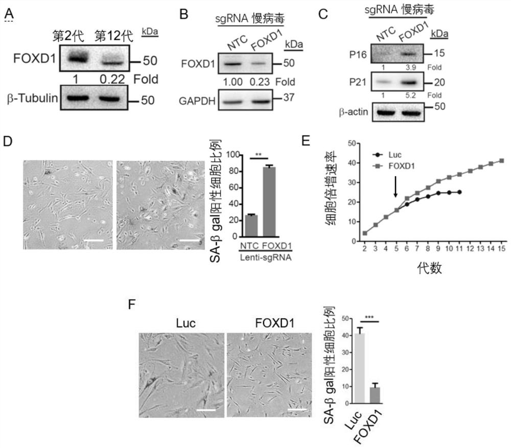 Application of foxd1 in preparation of products for treating and/or preventing animal osteoarthritis