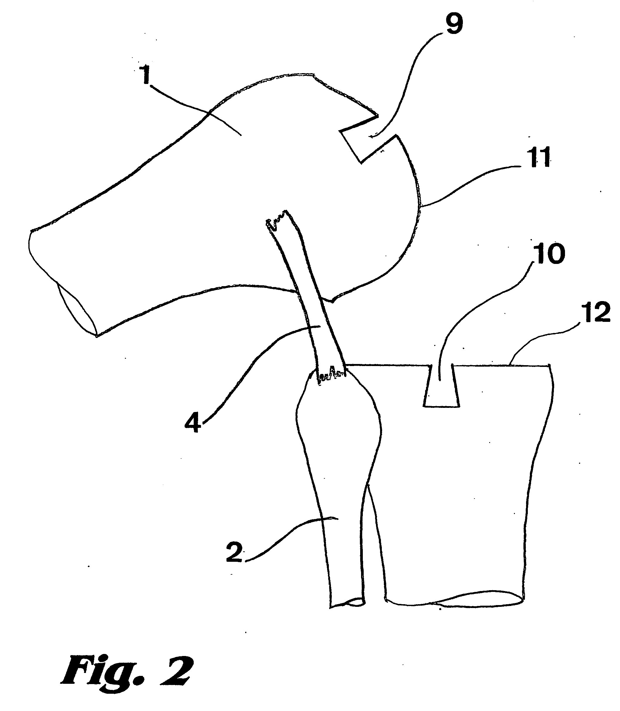 Bicondylar knee resurfacing prosthesis