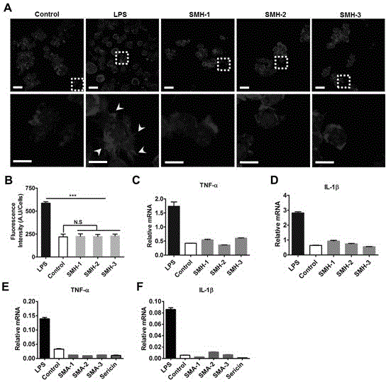 Photo-crosslinking sericin protein hydrogel and preparation method and application thereof