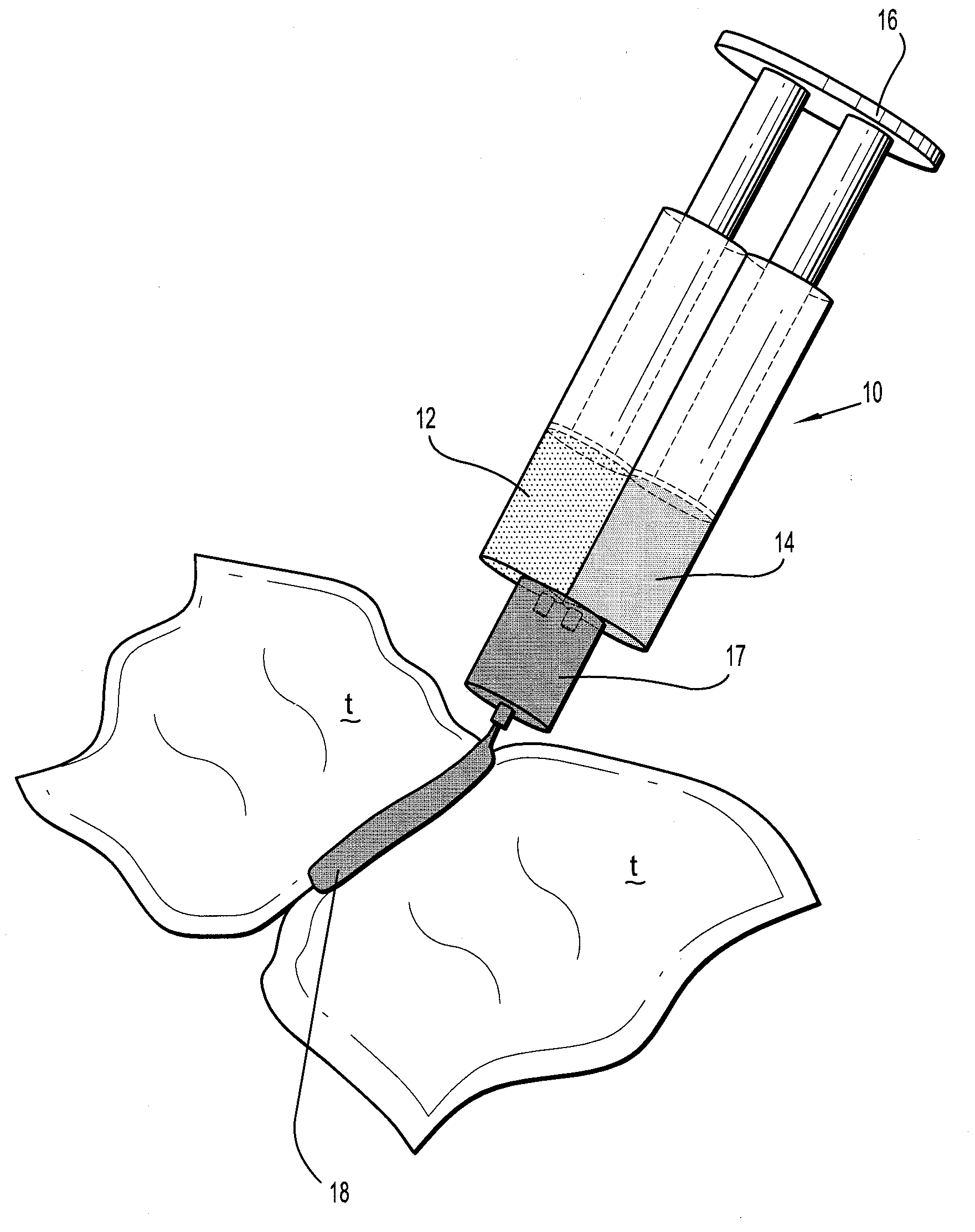 Bioabsorbable Surgical Compositions