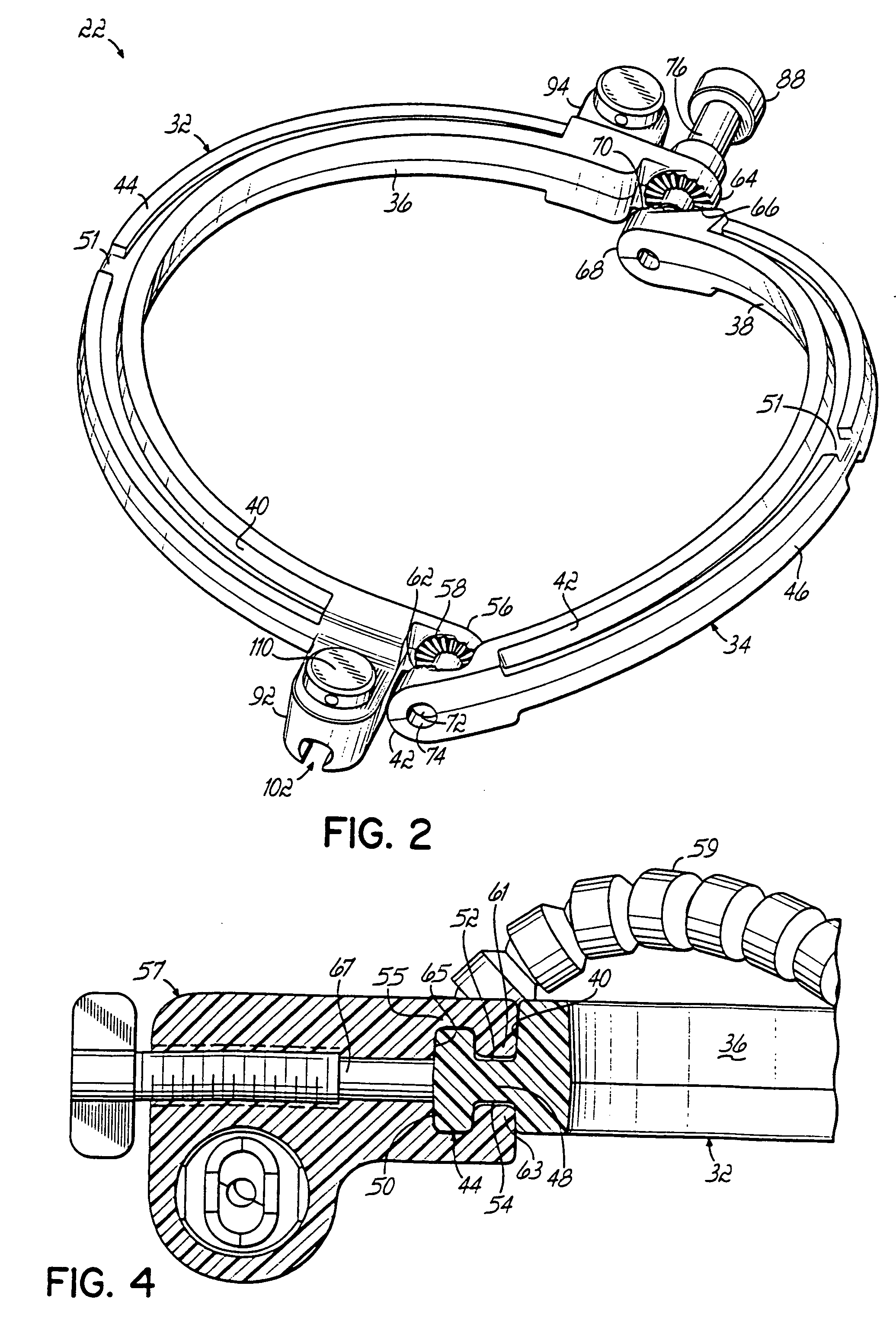 Radiolucent retractor and related components