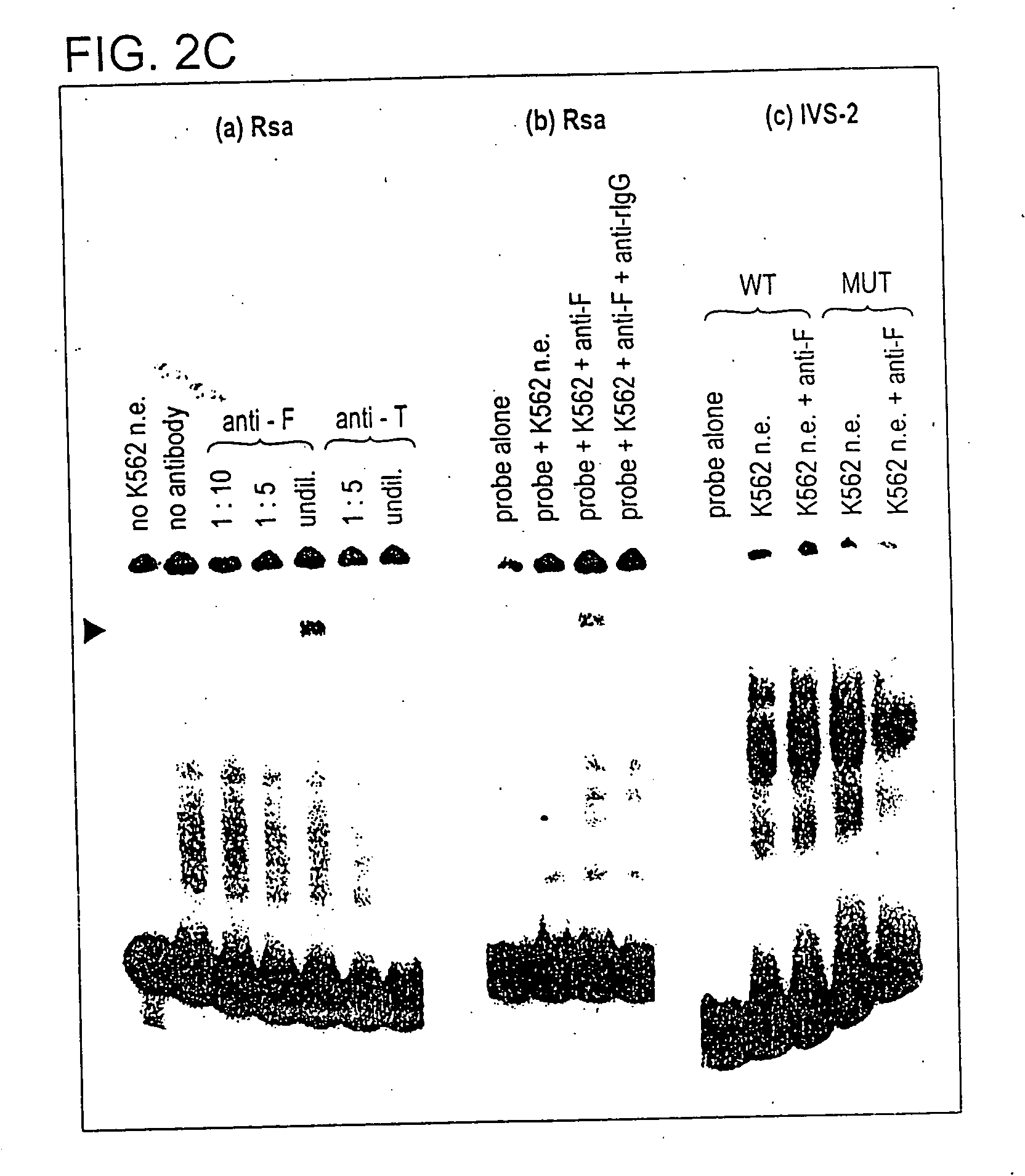 Gene regulation therapy involving ferritin