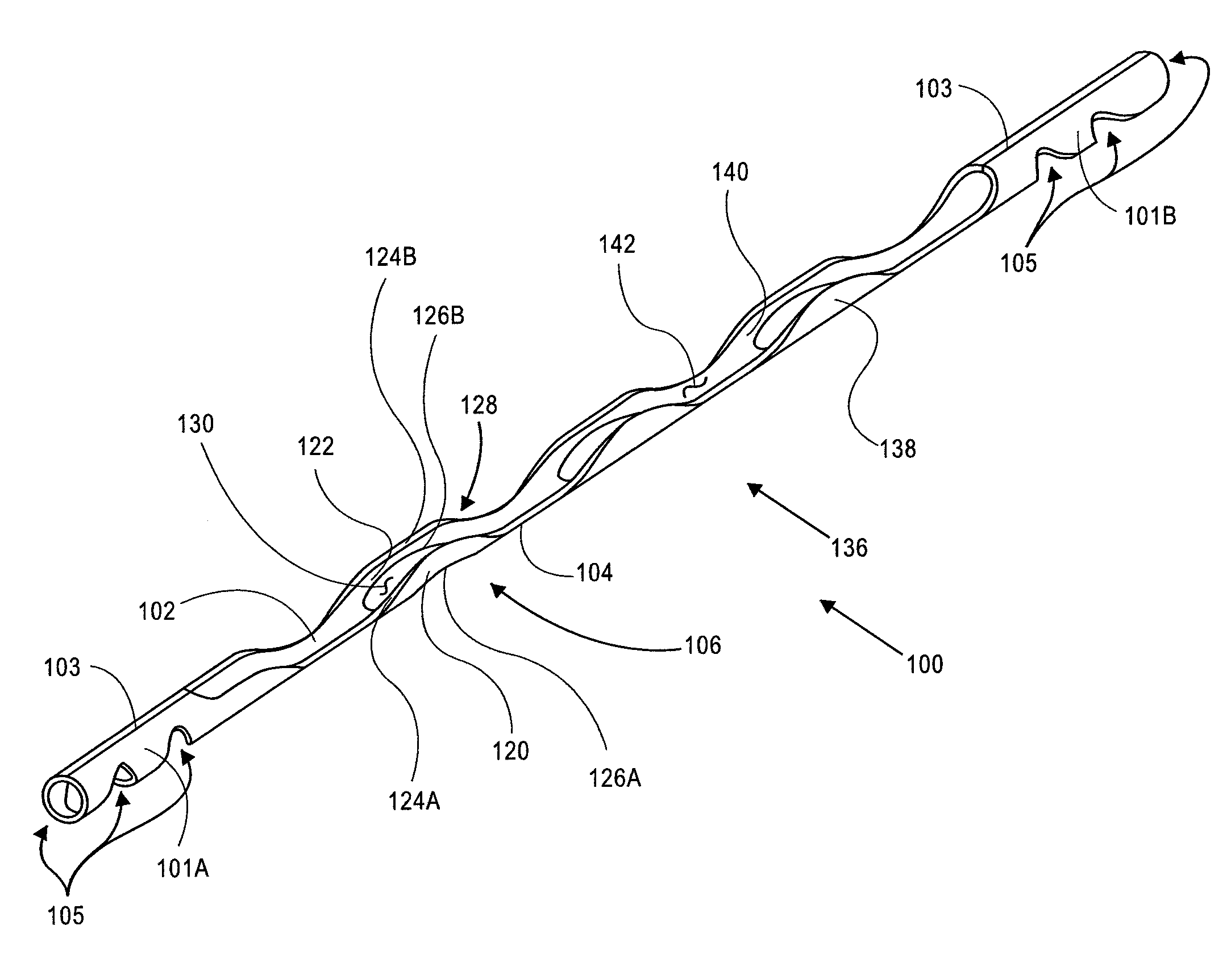 Methods and apparatus for treating glaucoma