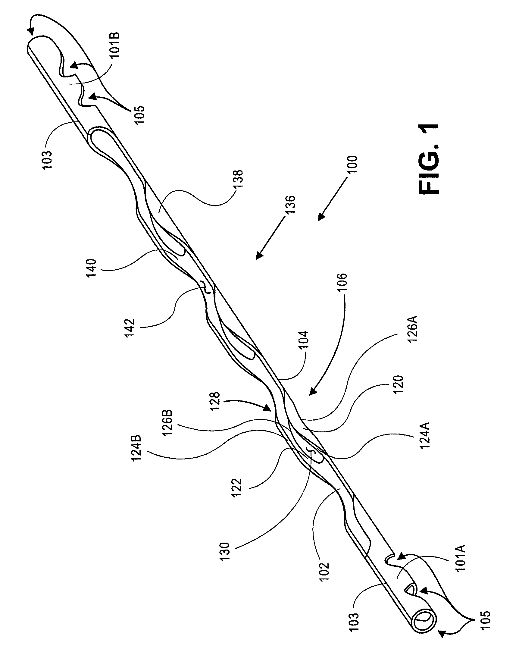 Methods and apparatus for treating glaucoma