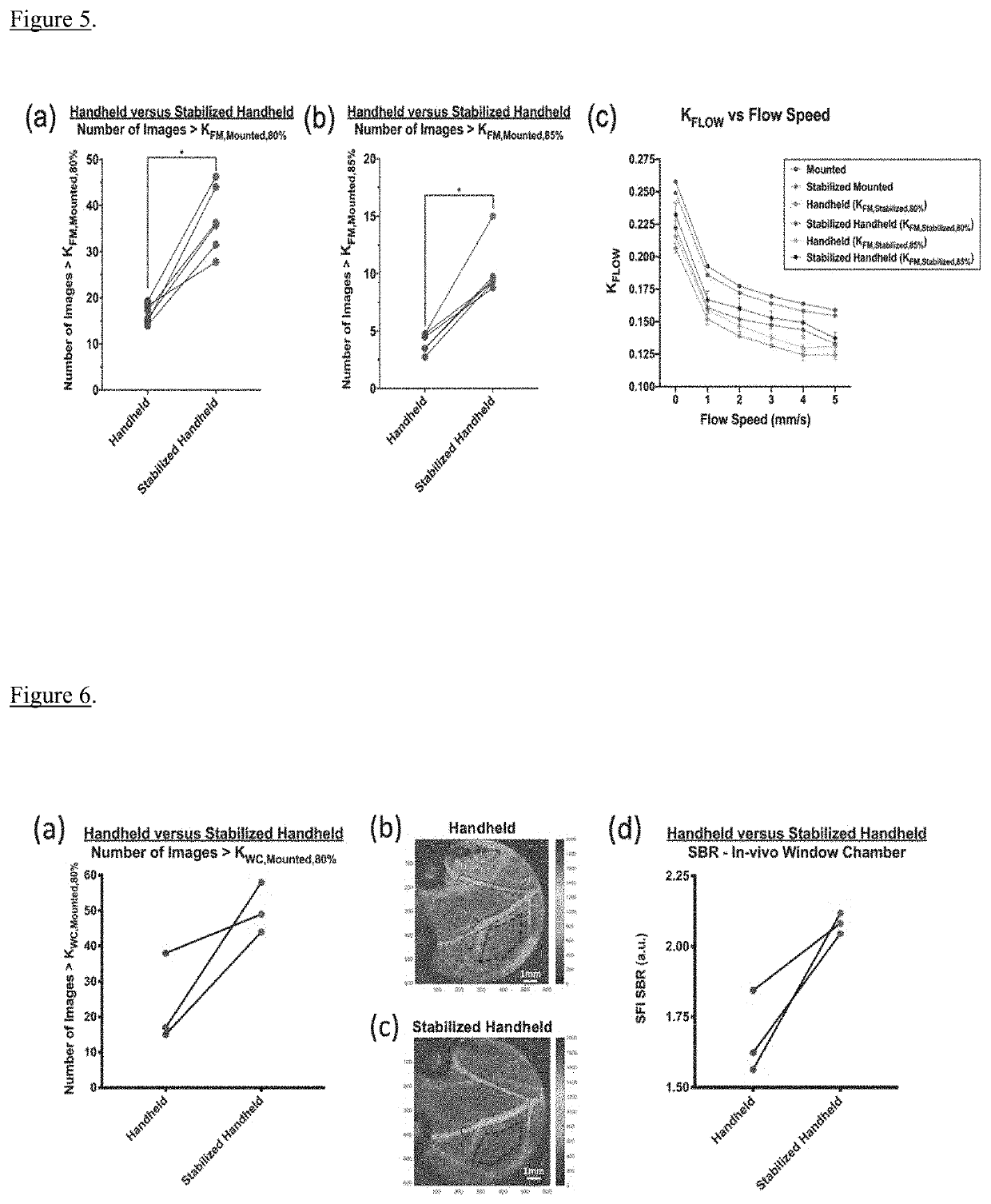 Motion stabilized laser speckle imaging