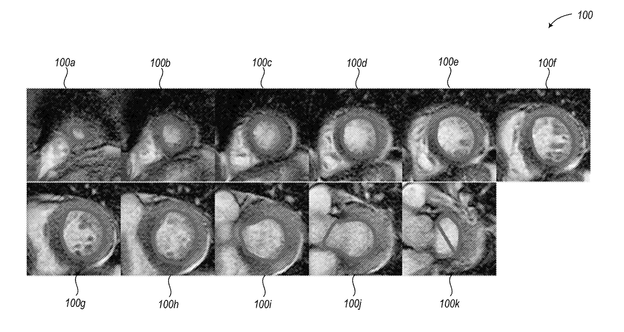 Automated cardiac volume segmentation