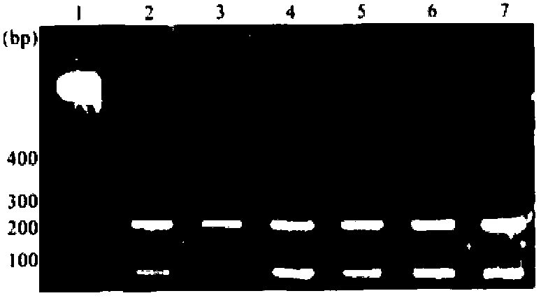 Kit for detecting estrogen acceptor alpha gene upstream TA repeated sequence, and its detection method