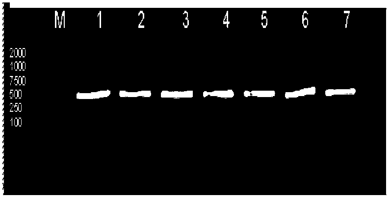 Kit for detecting estrogen acceptor alpha gene upstream TA repeated sequence, and its detection method