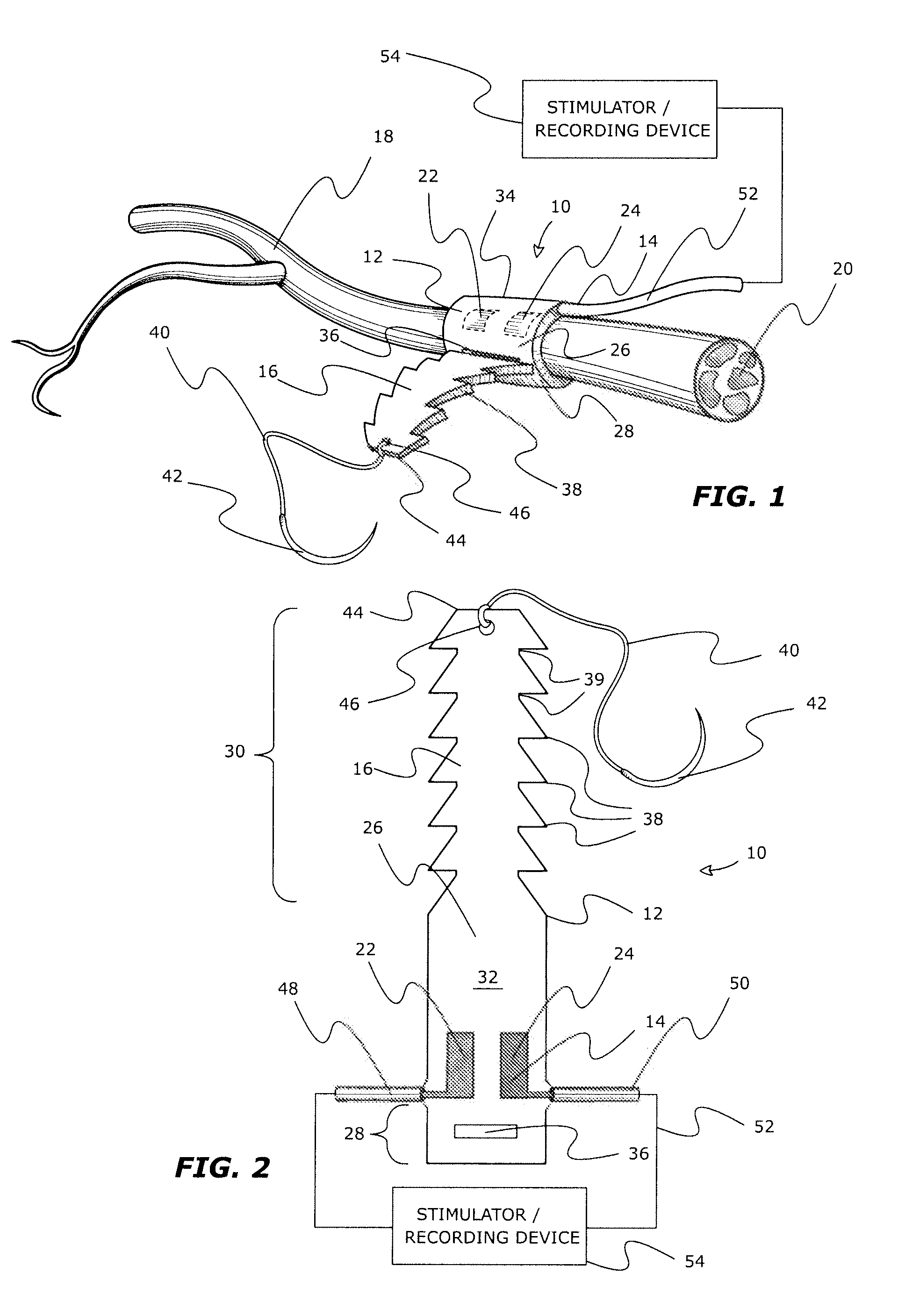 Adjustable tissue or nerve cuff and method of use