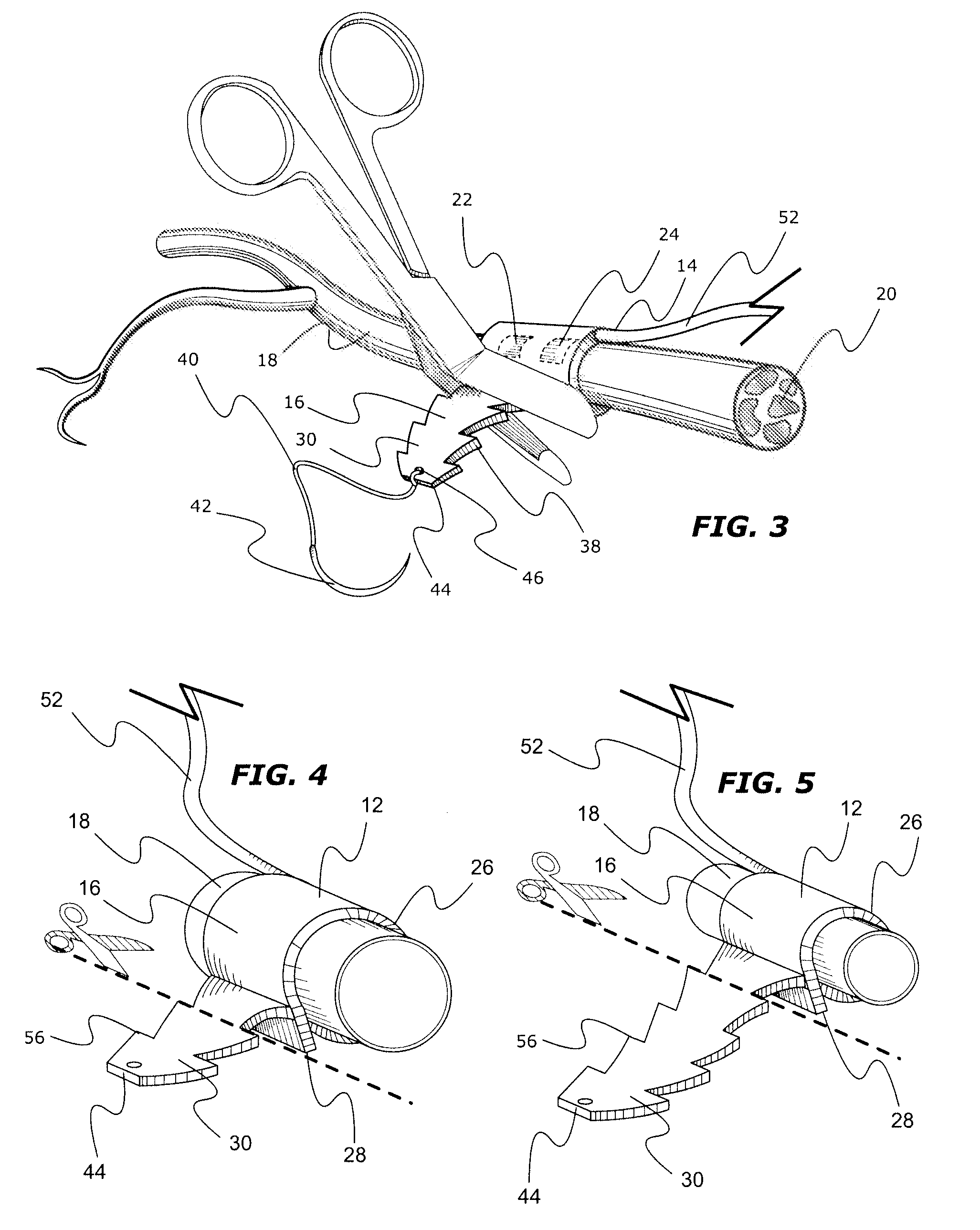 Adjustable tissue or nerve cuff and method of use