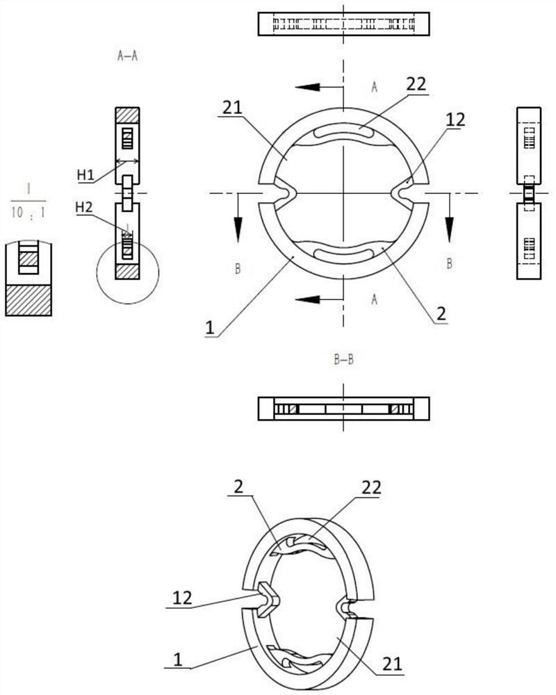 An adjustable intracapsular ring