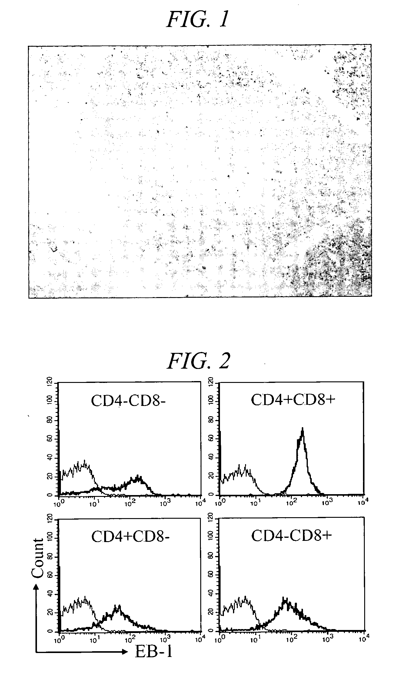 Acute leukemia and lymphoblastic lymphoma-specific CD43 epitope and use thereof