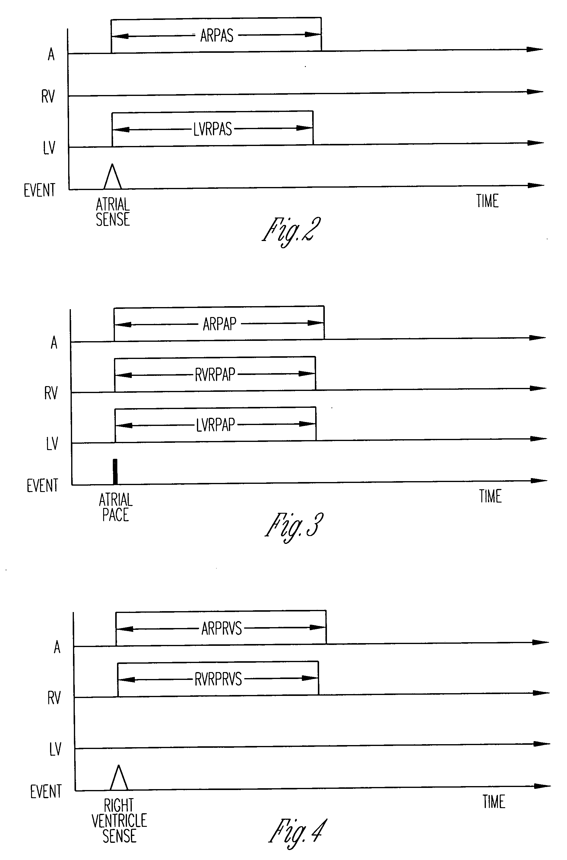 System and method for managing refractory periods in a cardiac rhythm management device with biventricular sensing