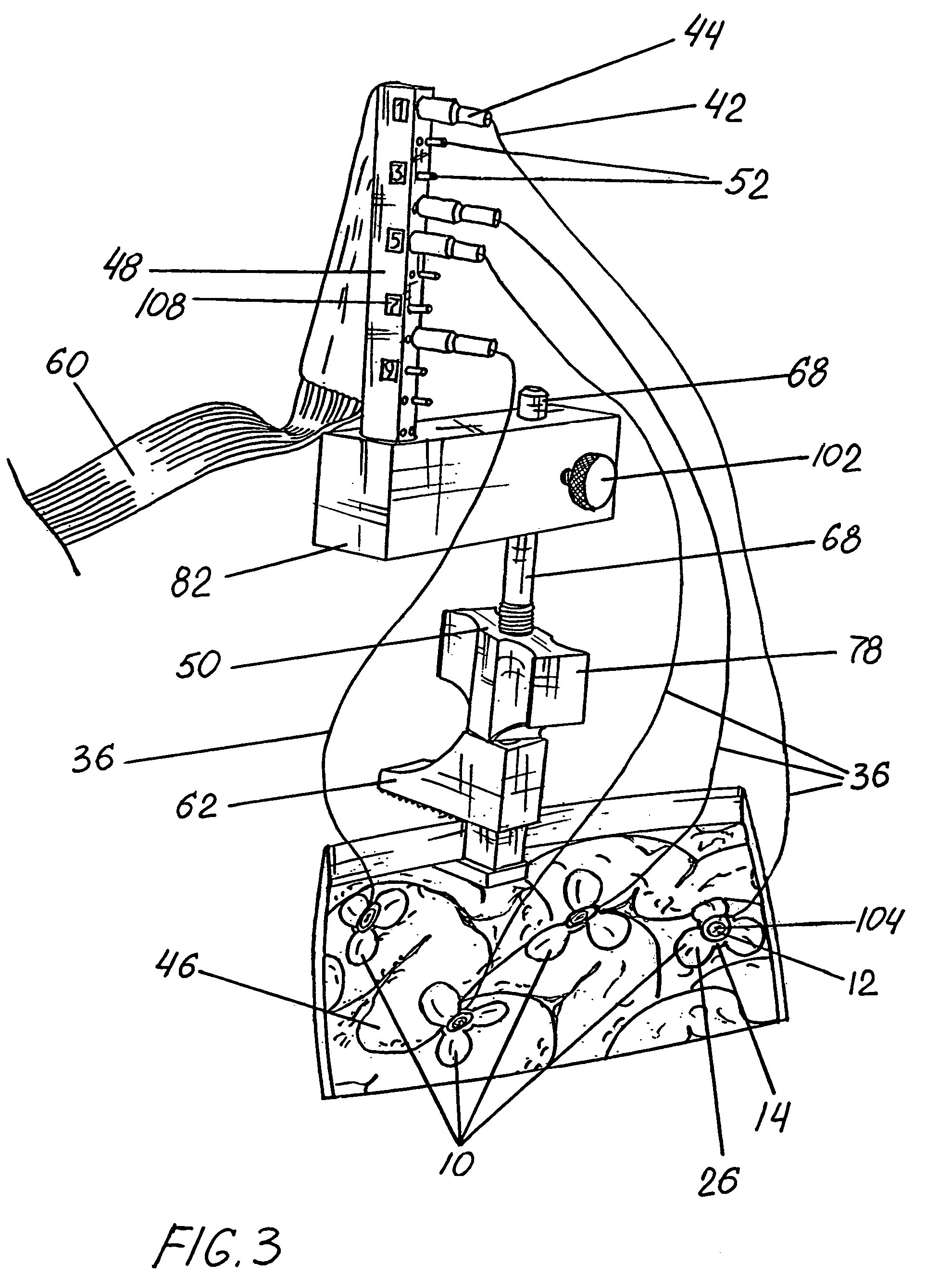 Cortical sensing device with pads