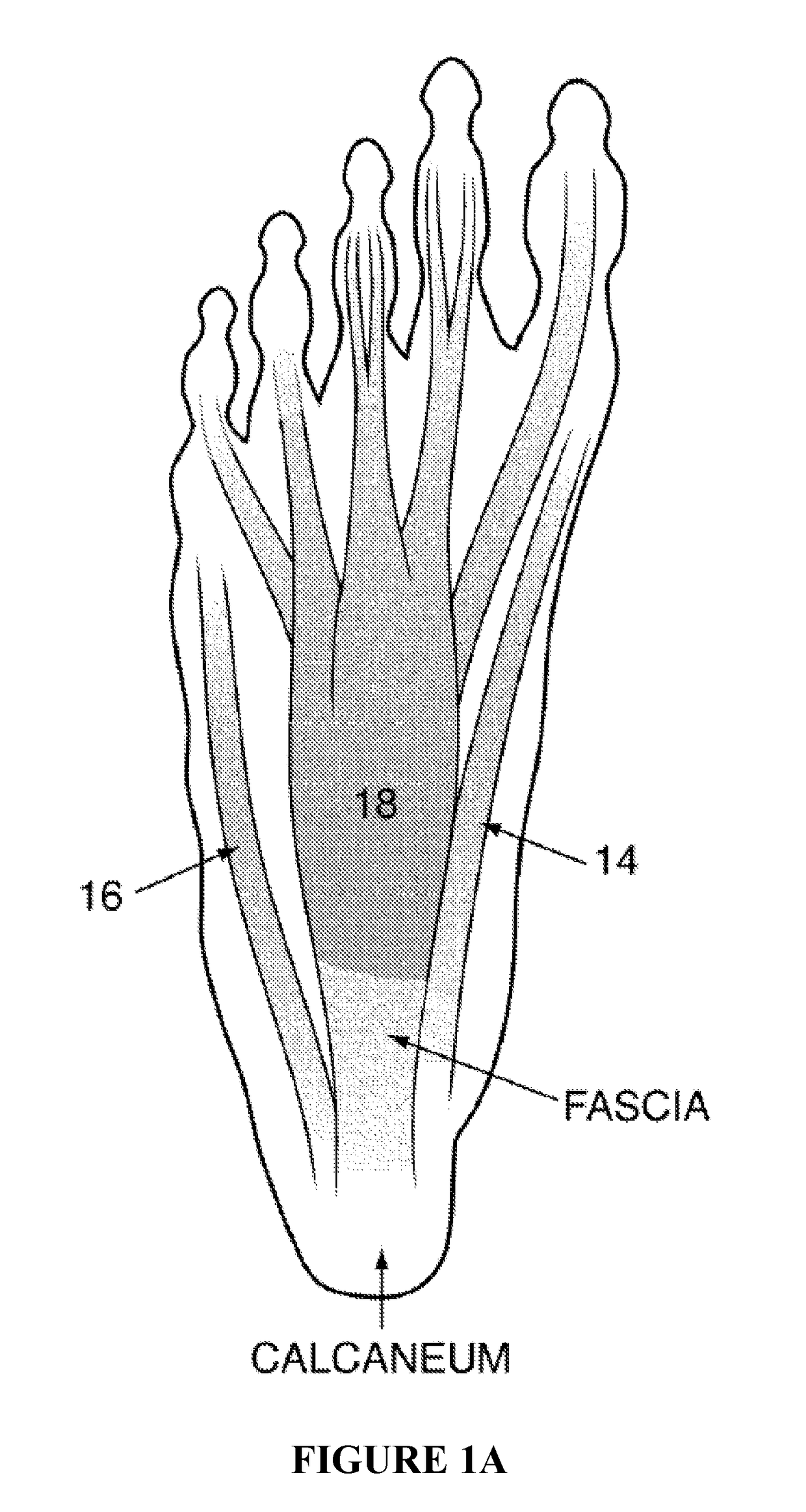 Method and apparatus for noninvasive inhibition of deep vein thrombosis