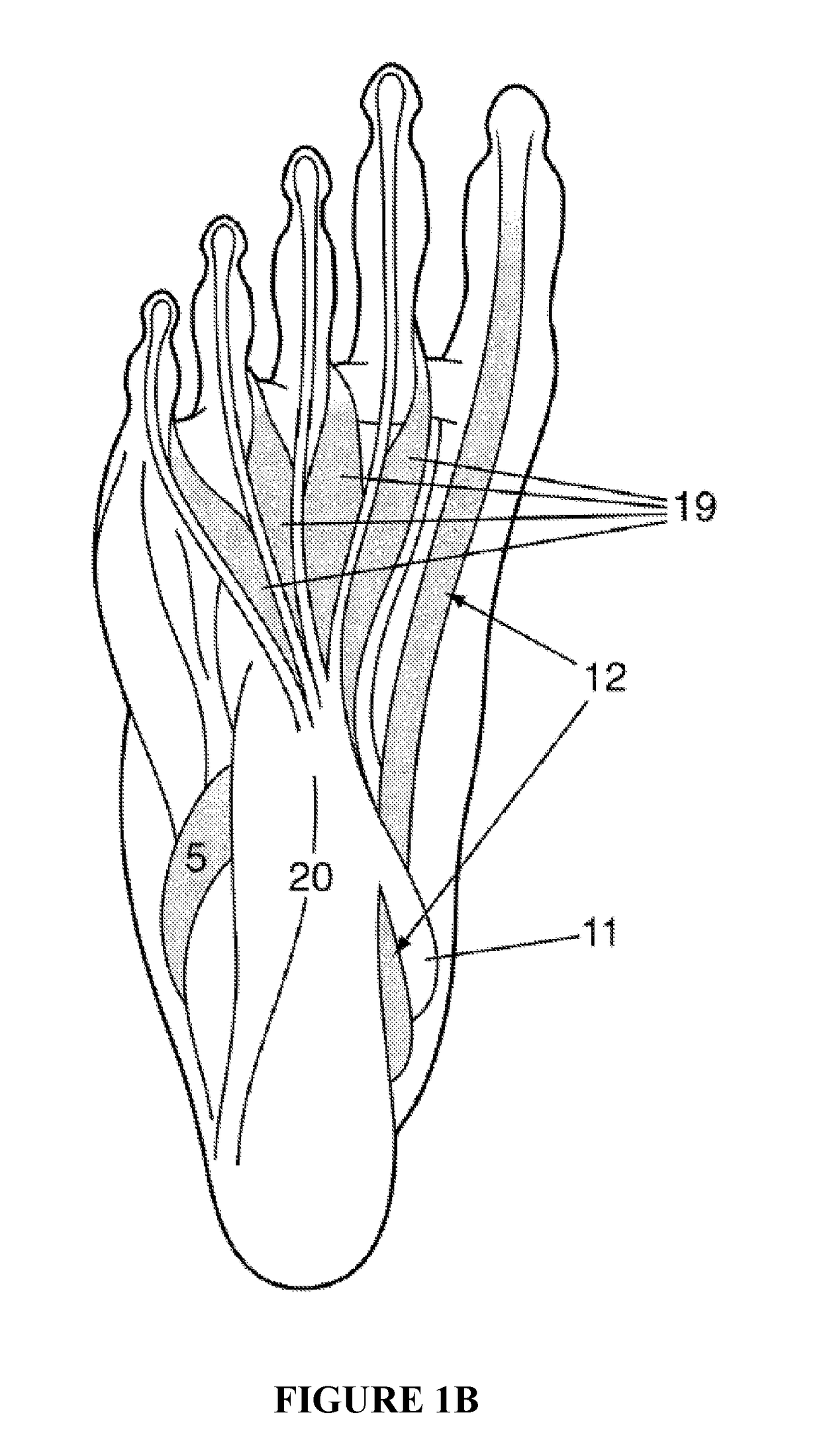 Method and apparatus for noninvasive inhibition of deep vein thrombosis