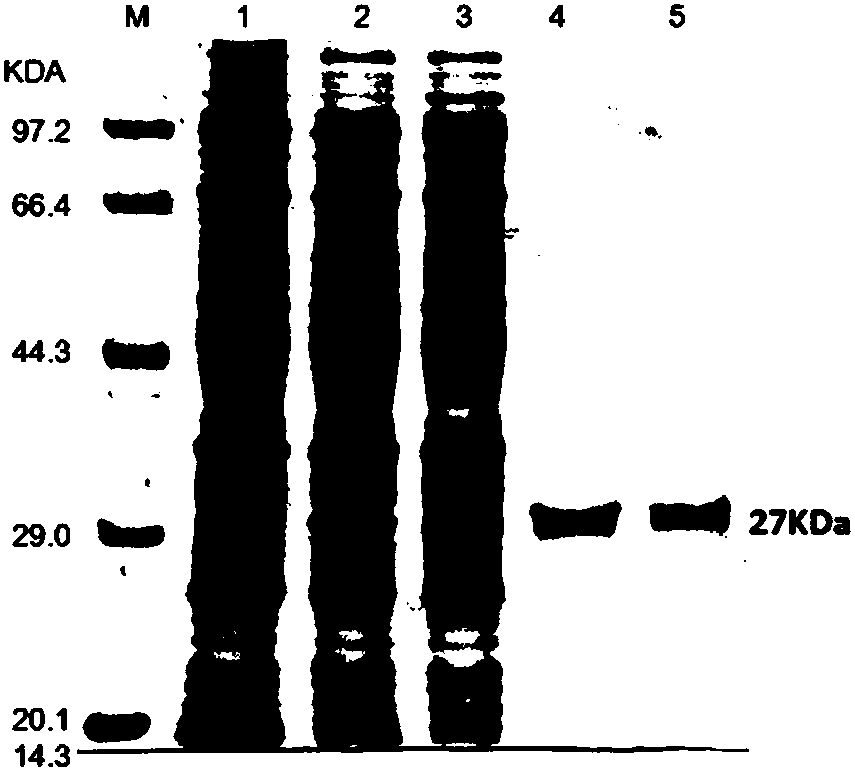 PRV (pesudorabies virus) gB monoclonal antibody and application thereof