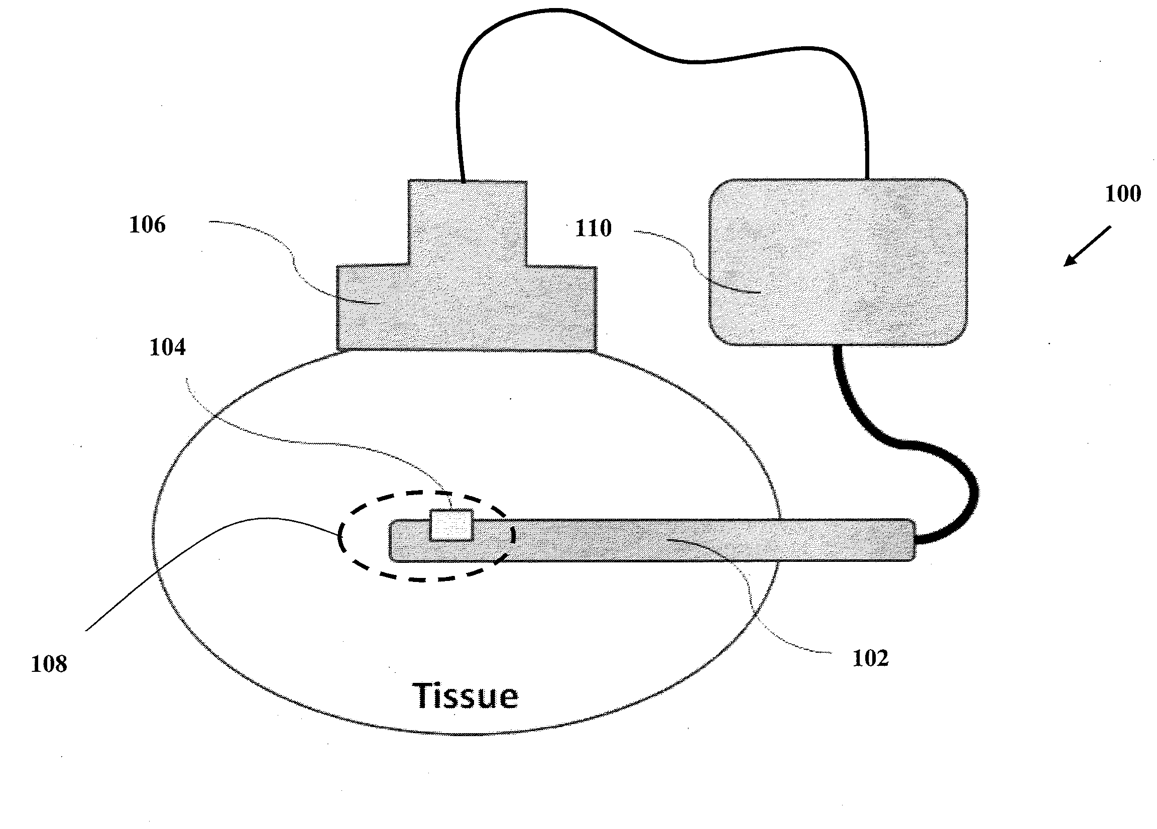 Real time ultrasound thermal dose monitoring system for tumor ablation therapy