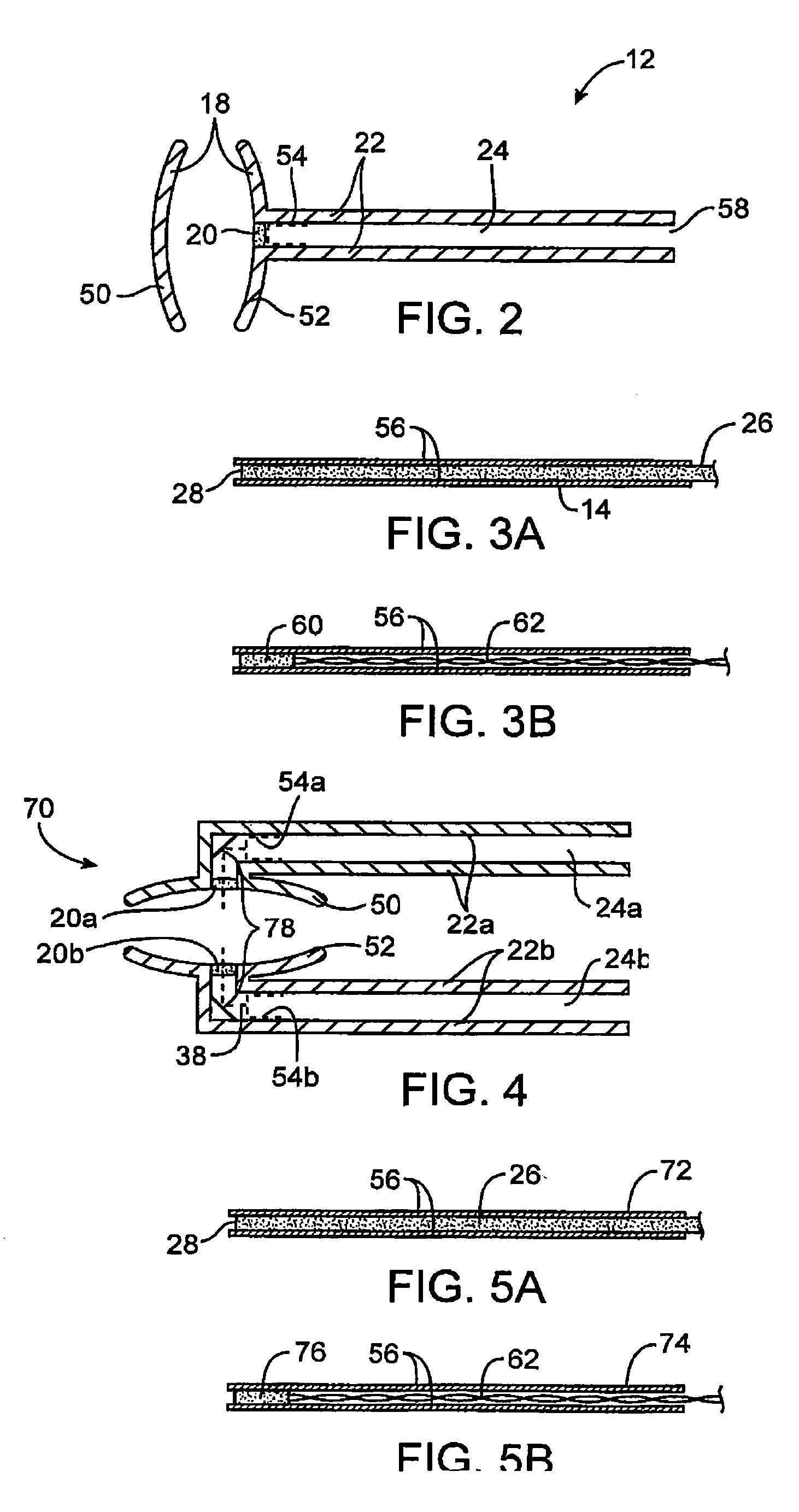 Oral health measurement clamping probe, system, and method