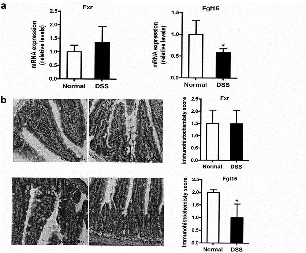 Application of PPAR alpha-UGT (peroxisome proliferator activated receptor alpha-uridine diphosphate glucuronosyl transferase) pathway inhibitor in treating inflammatory bowel diseases