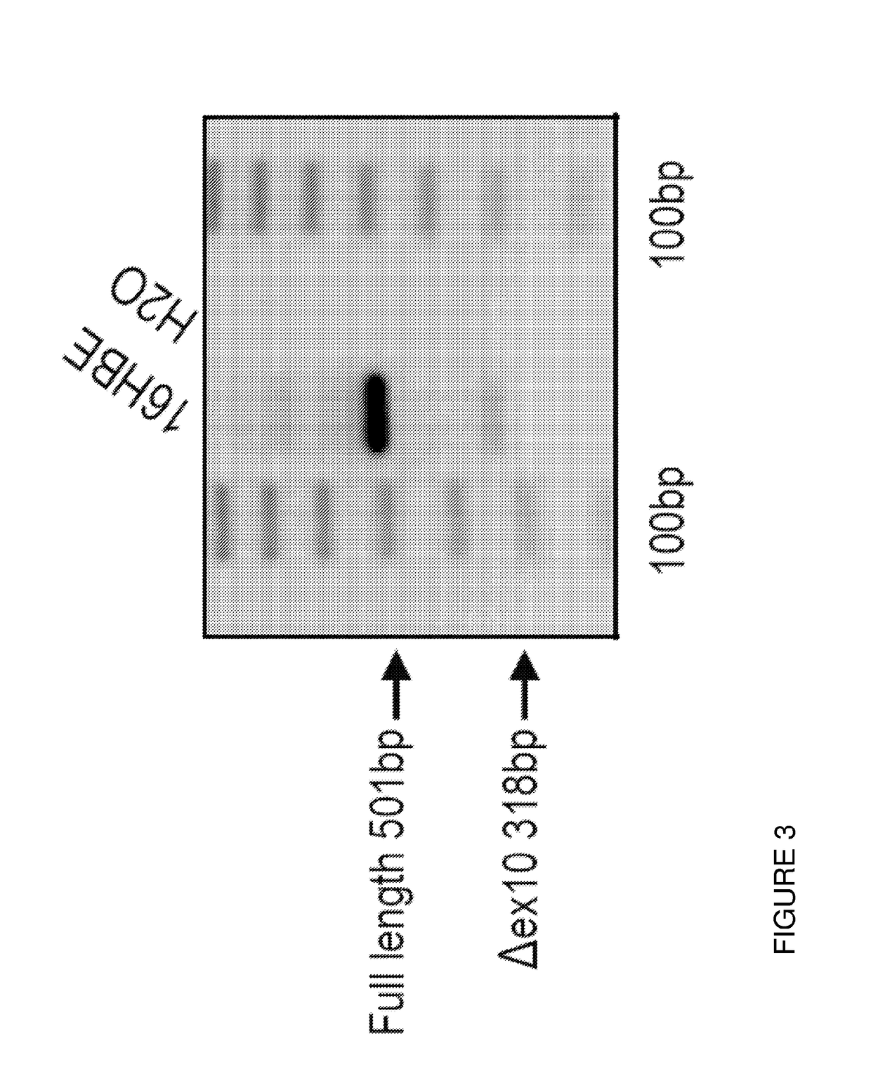 Restoration of the cftr function by splicing modulation