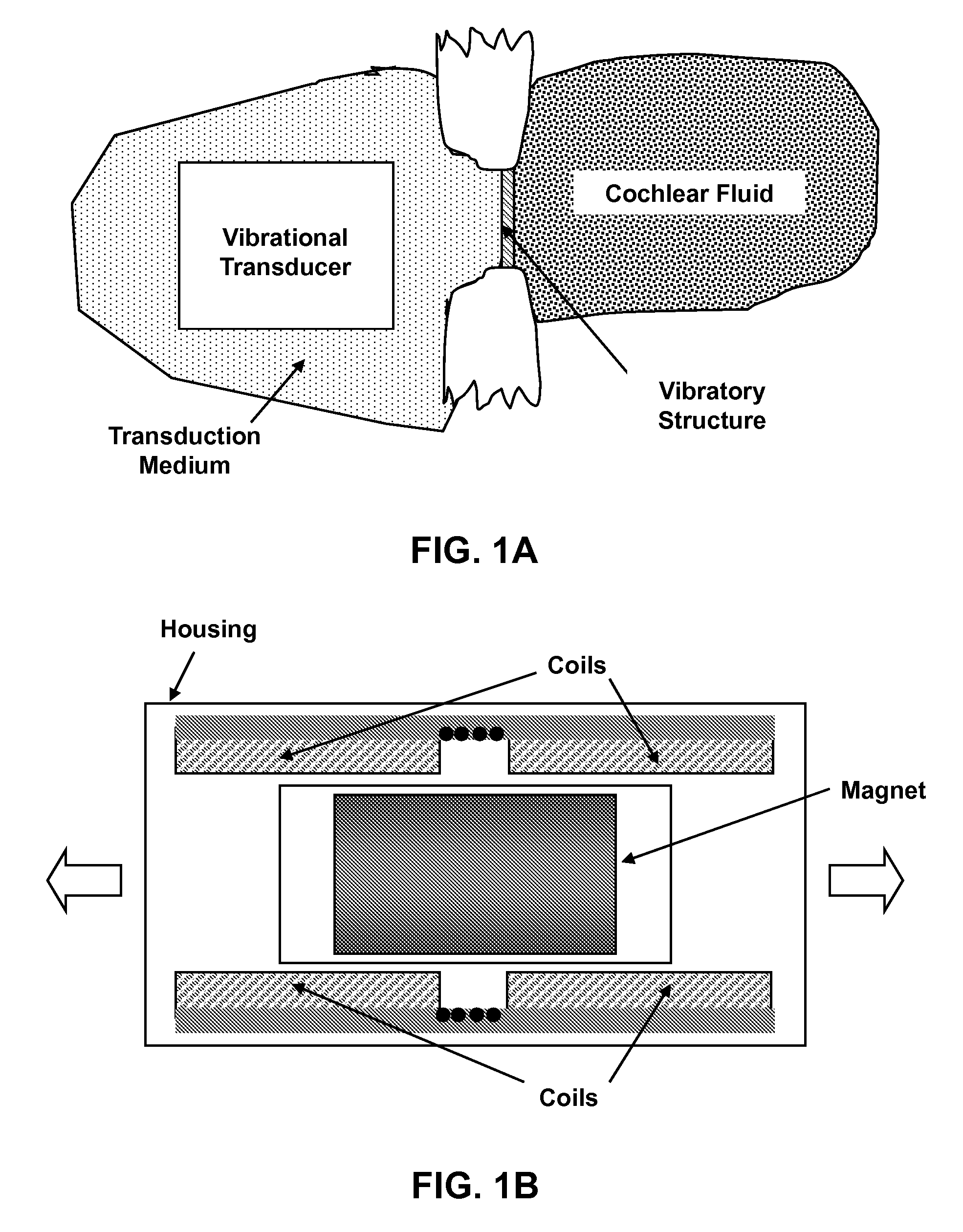 Implantable Auditory Stimulation Systems Having a Transducer and a Transduction Medium