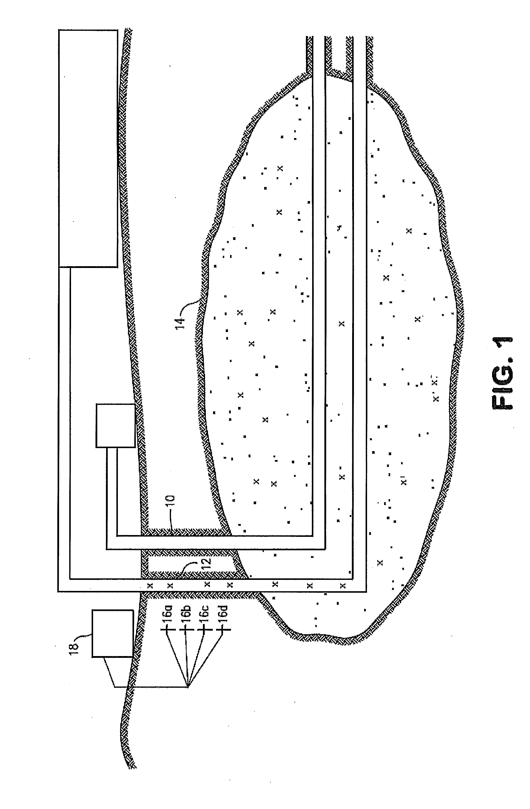 In-situ upgrading of heavy crude oil in a production well using radio frequency or microwave radiation and a catalyst