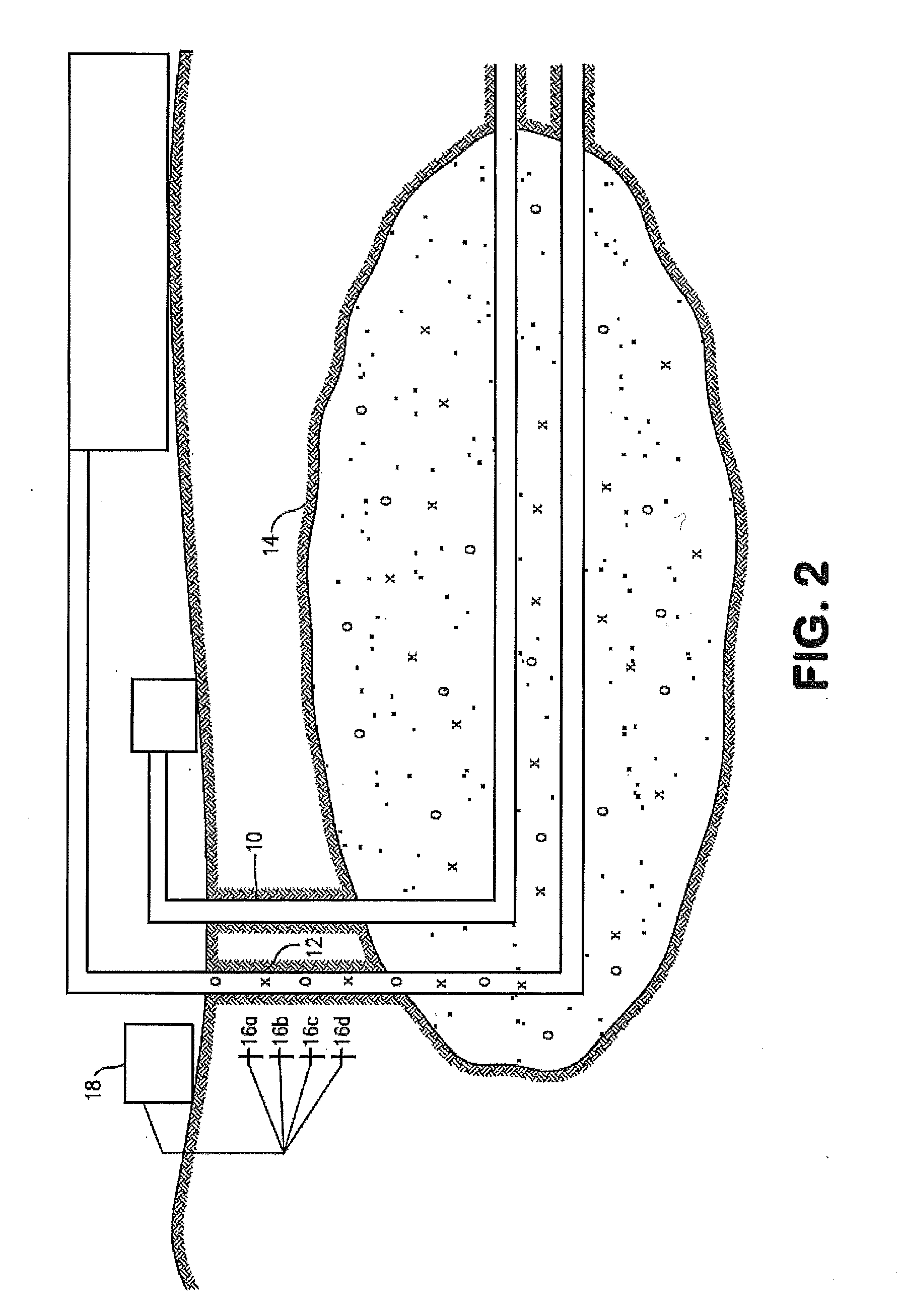 In-situ upgrading of heavy crude oil in a production well using radio frequency or microwave radiation and a catalyst