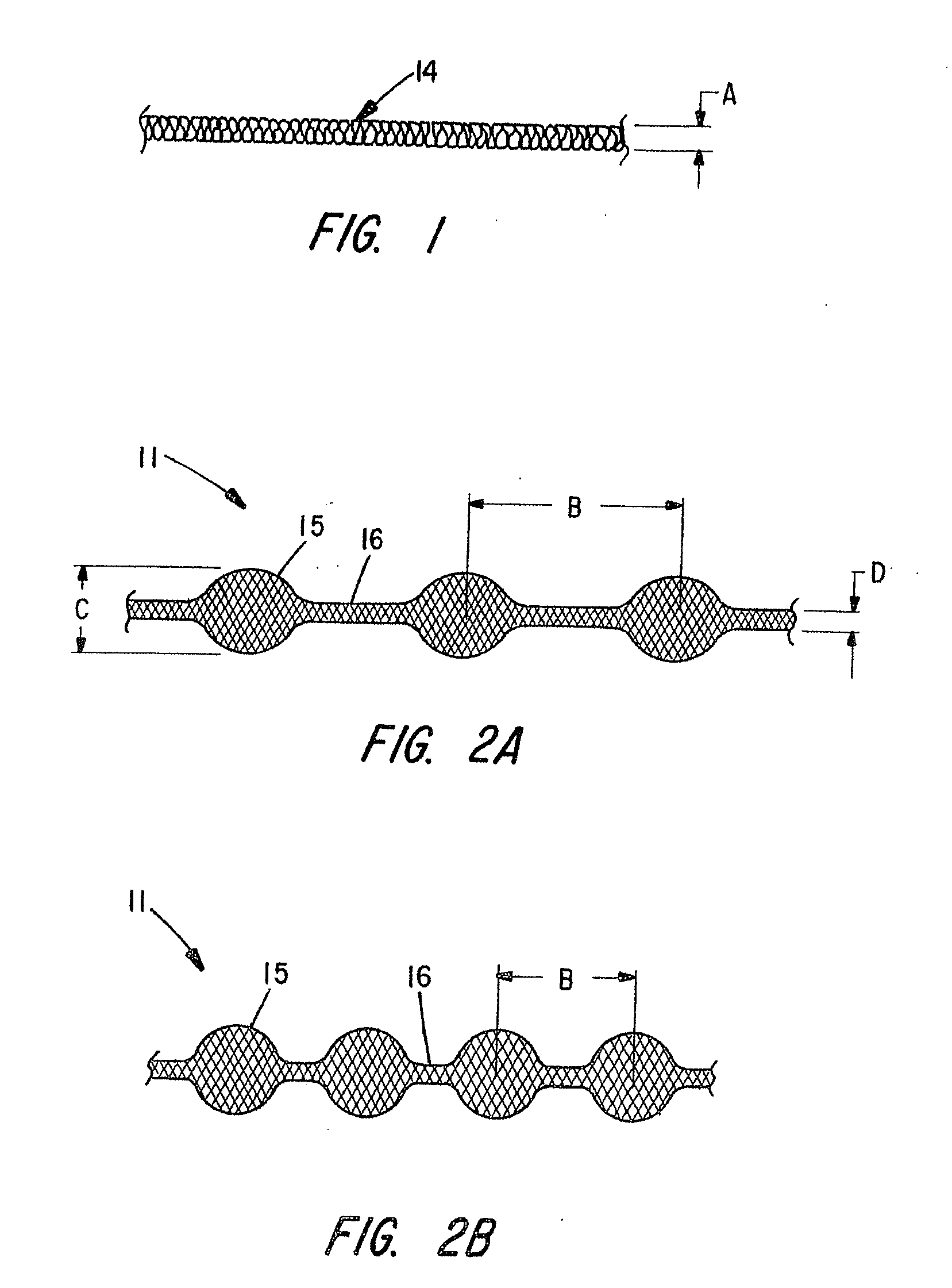 Braided occlusion device having repeating expanded volume segments separated by articulation segments