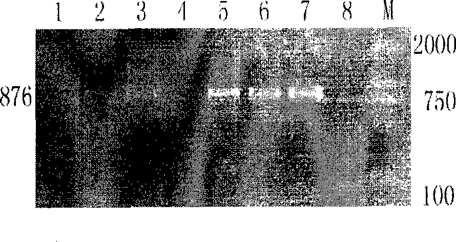 Reagent for detection of pathogenic hydrophila gingivalis and detection method thereof