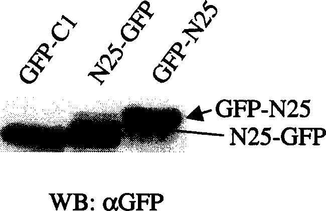 Obtainment of cell growth inhibiting polypeptide and its usage