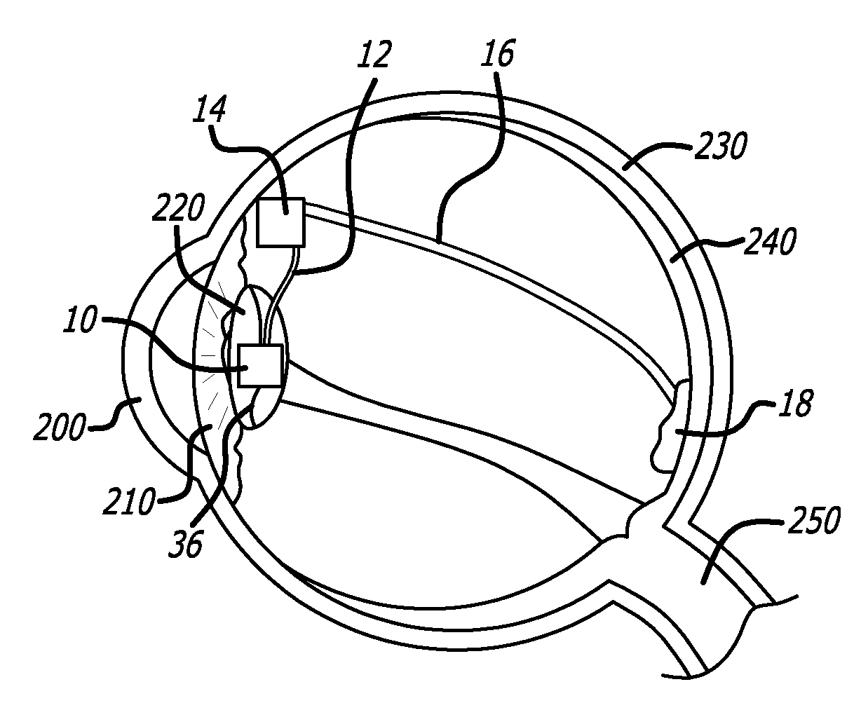 Intraocular camera for retinal prostheses