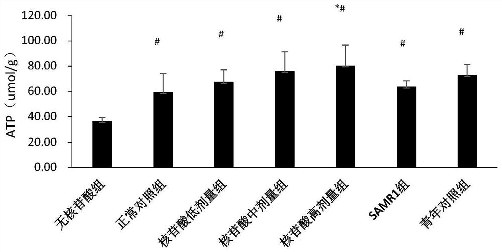 Application of nucleotide mixture in preparing preparations for preventing or alleviating senile sarcopenia