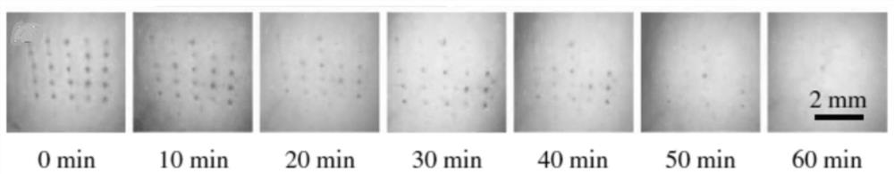 A kind of microneedle patch and preparation method thereof