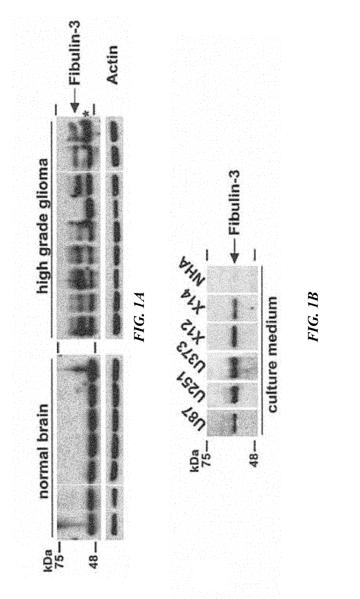 Anti-fibulin-3 antibodies and uses thereof