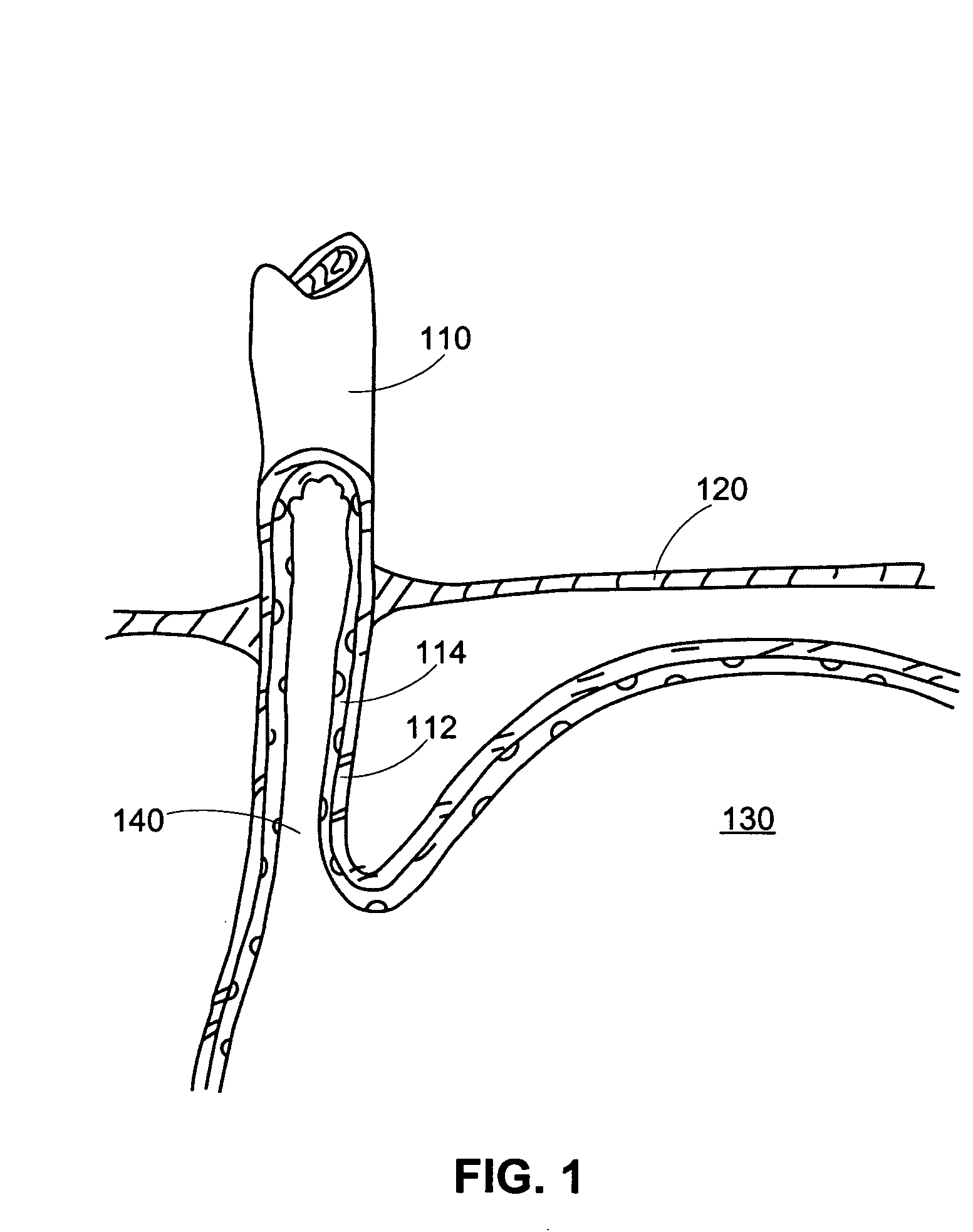 Methods and apparatus for implanting devices into non-sterile body lumens or organs