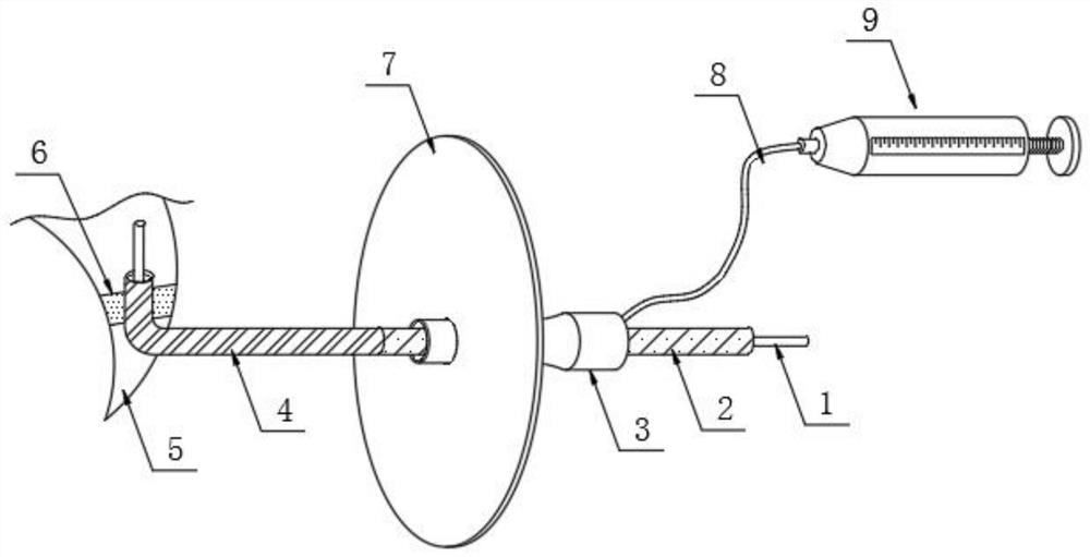 Choledochoscope guider in laparoscopic surgery