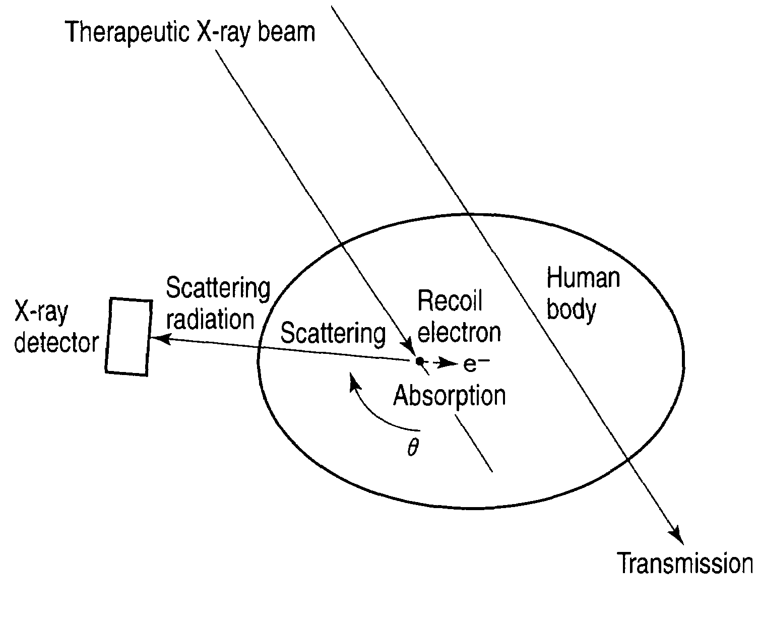 Radiotherapeutic system and radiotherapeutic dose distribution measuring method